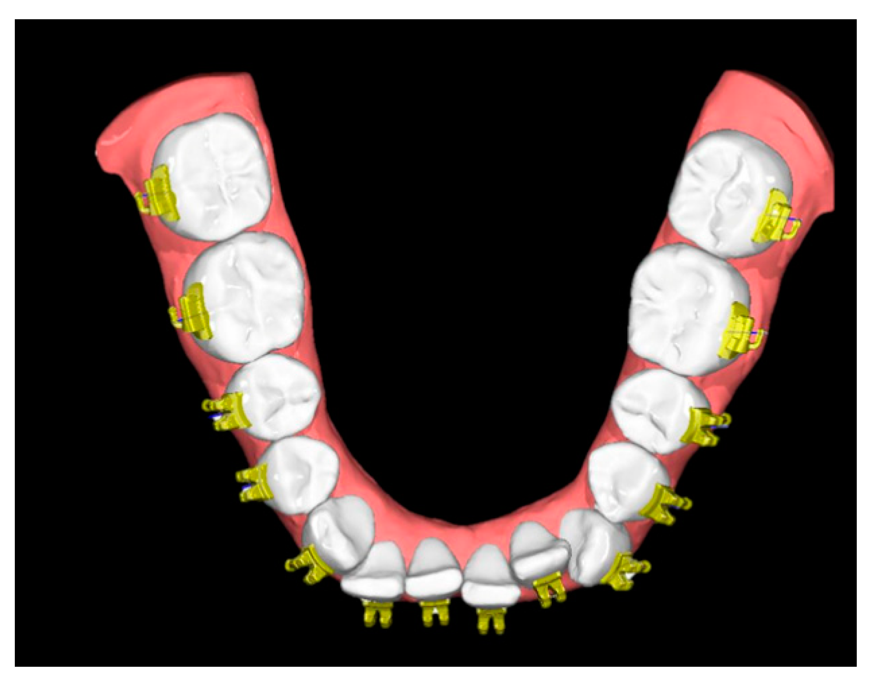 Applsci 11 06013 g003