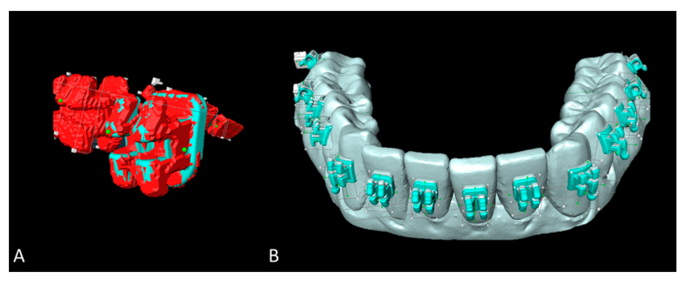 Applsci 11 06013 g005