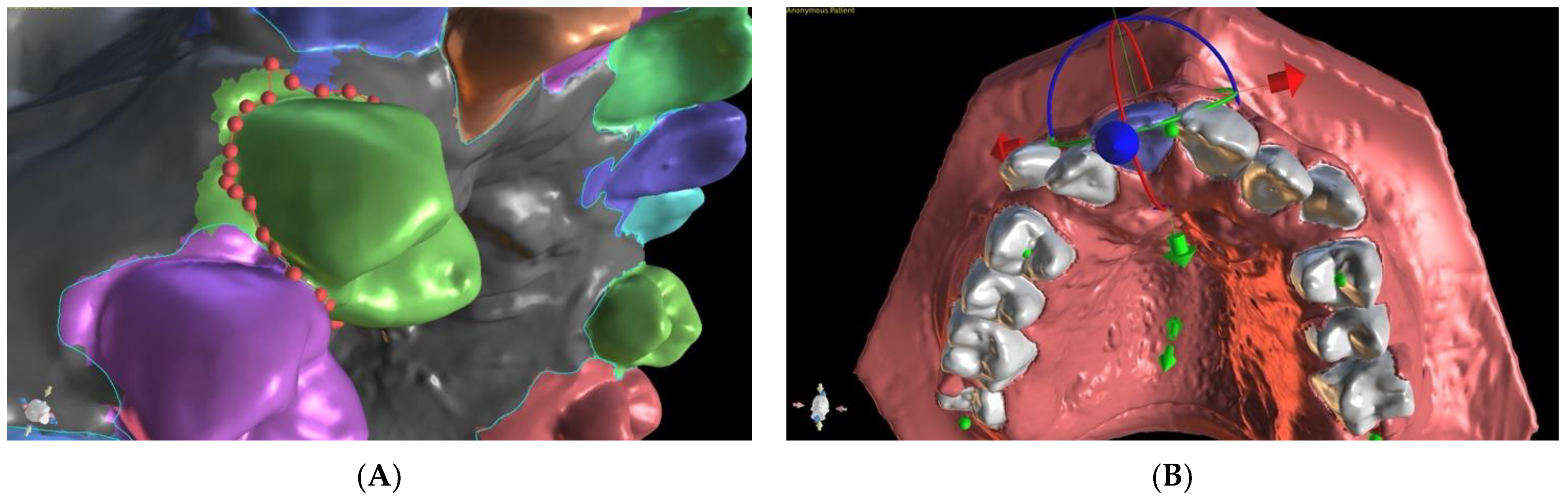 Applsci 11 06033 g002