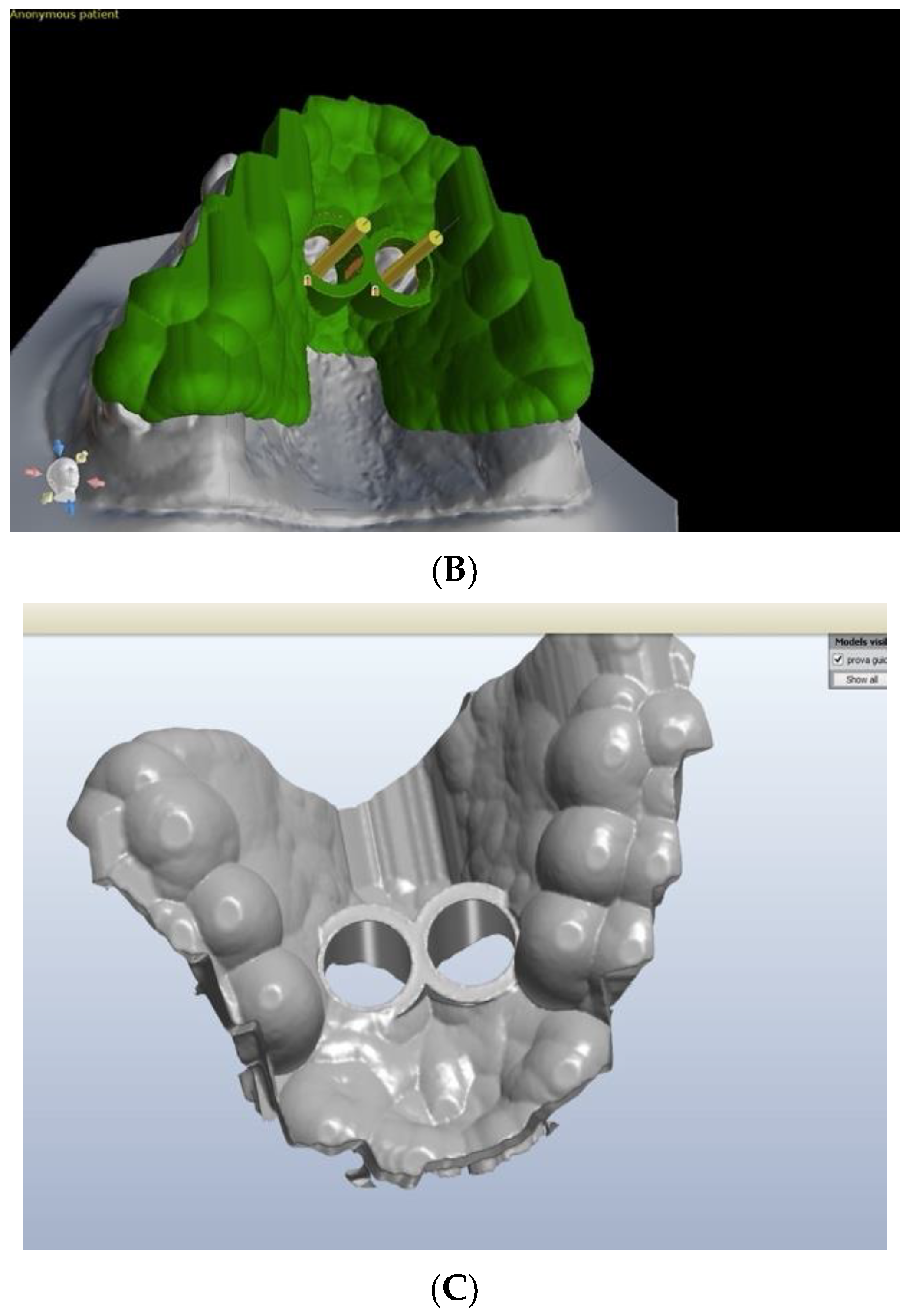 Applsci 11 06033 g003b