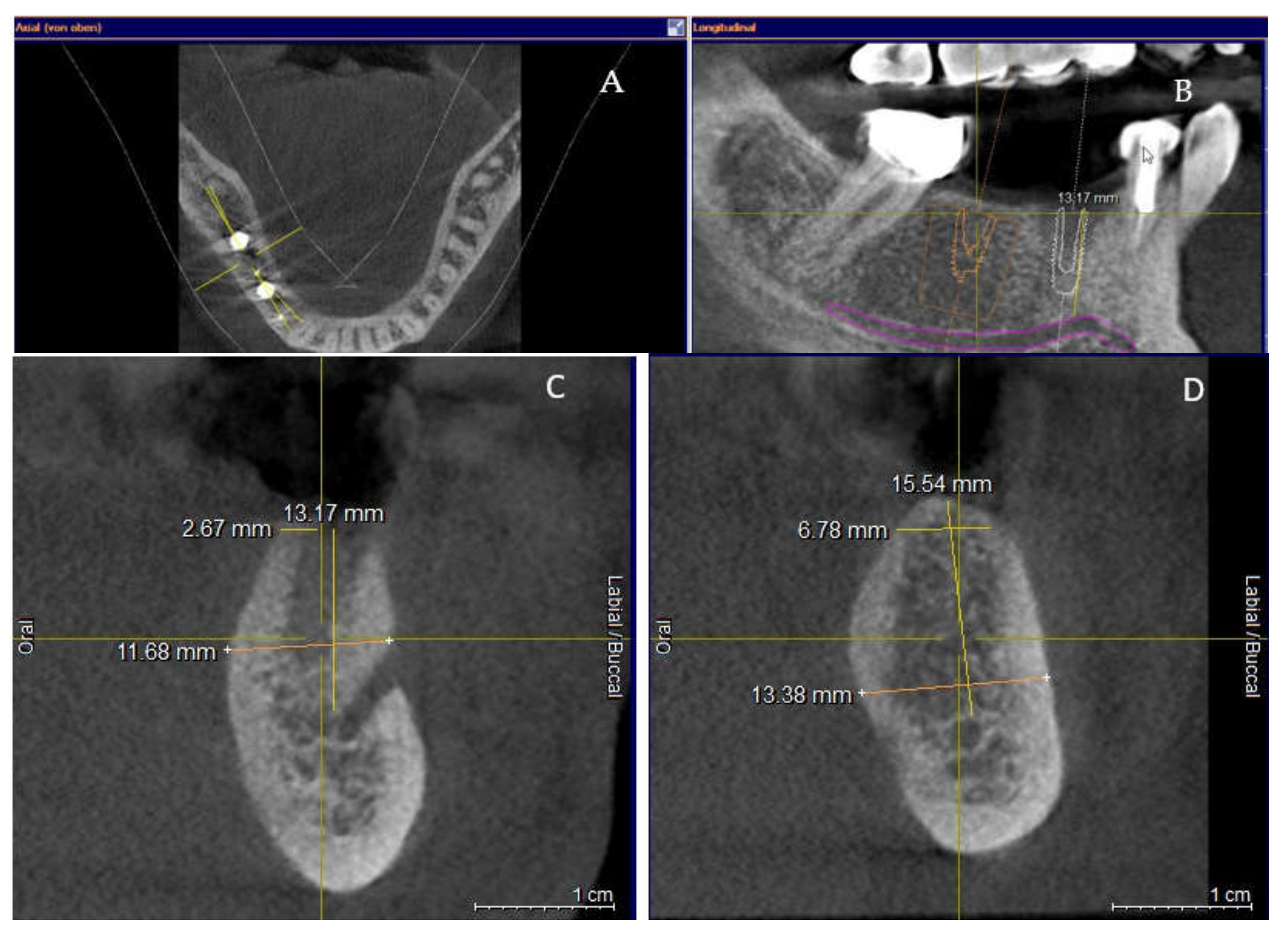 Applsci 11 06054 g001