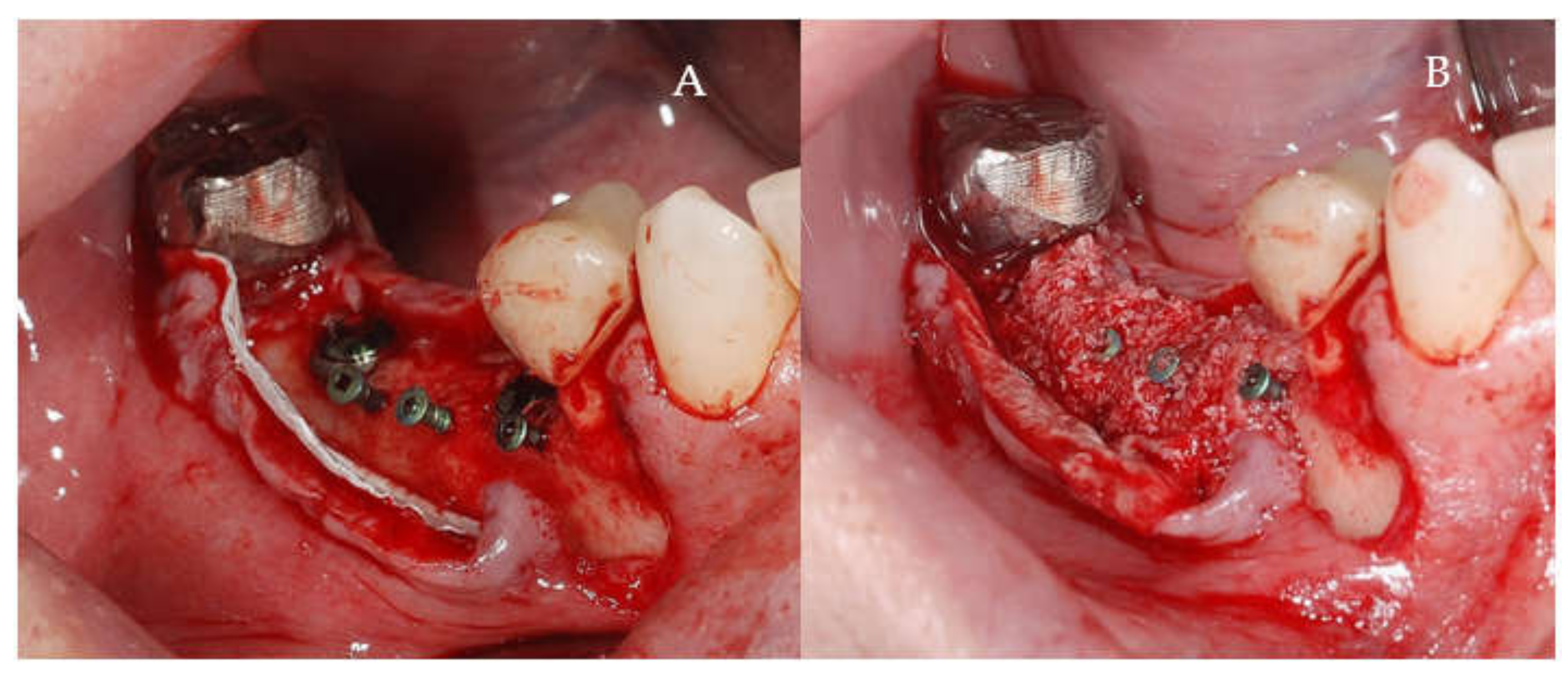 Applsci 11 06054 g004