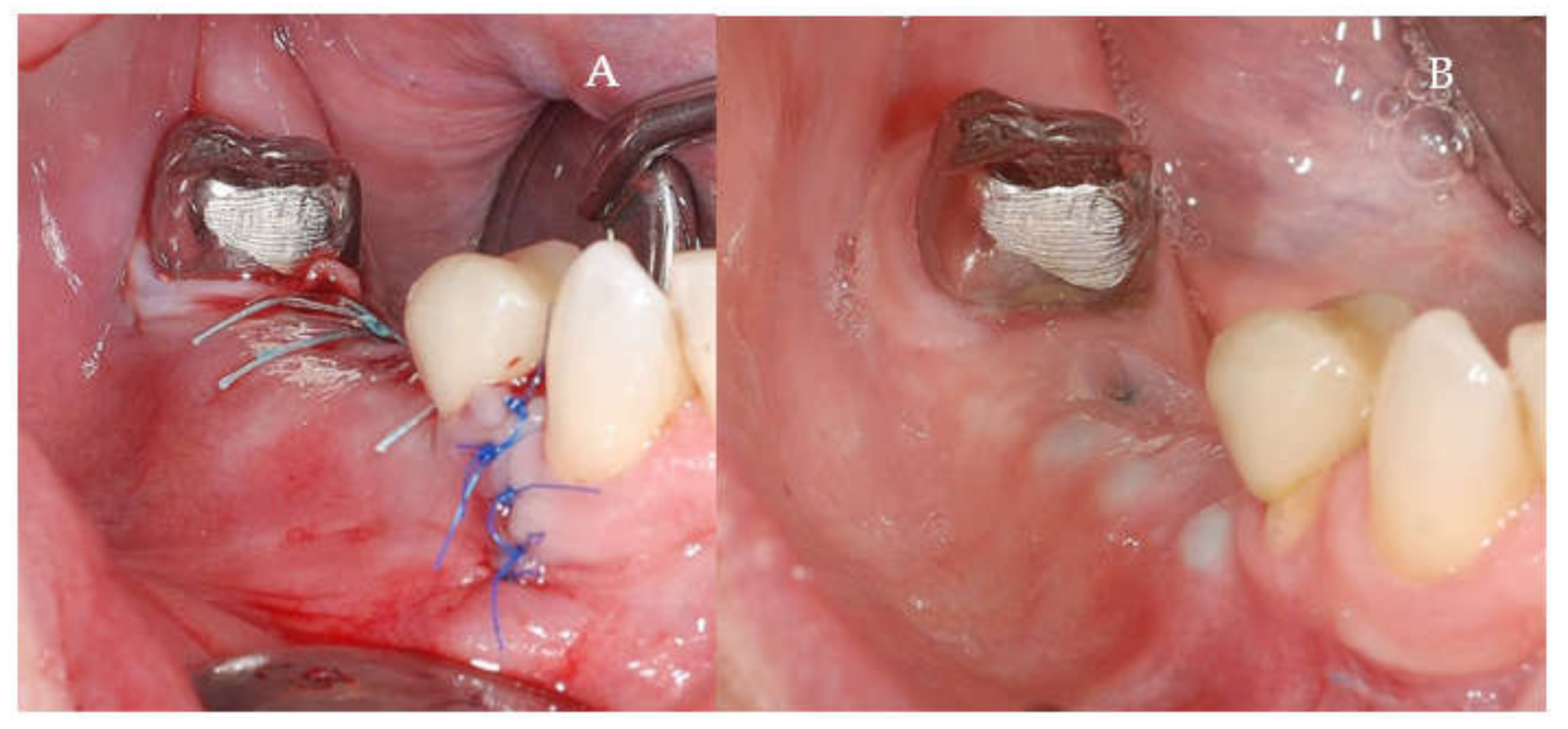 Applsci 11 06054 g005