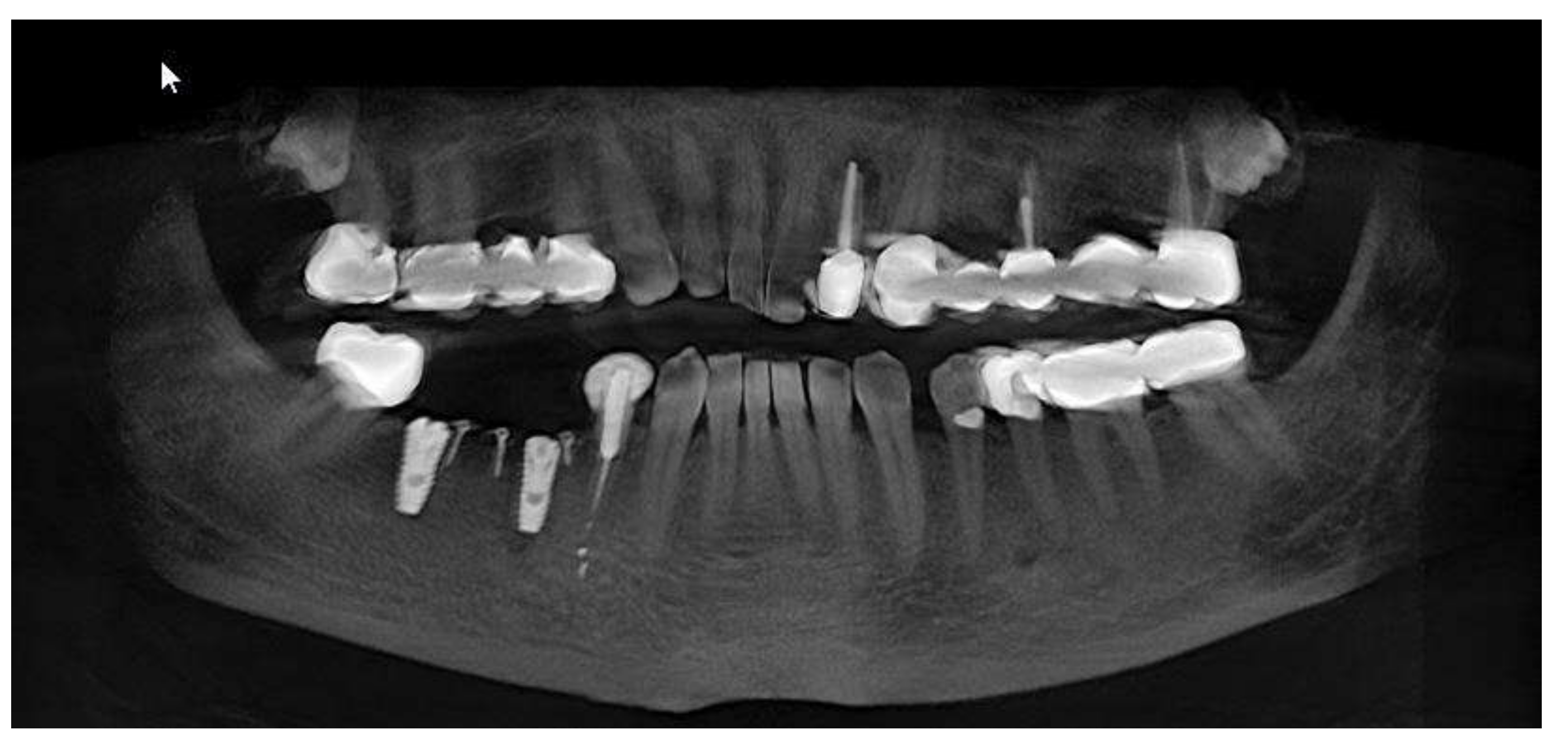 Applsci 11 06054 g006