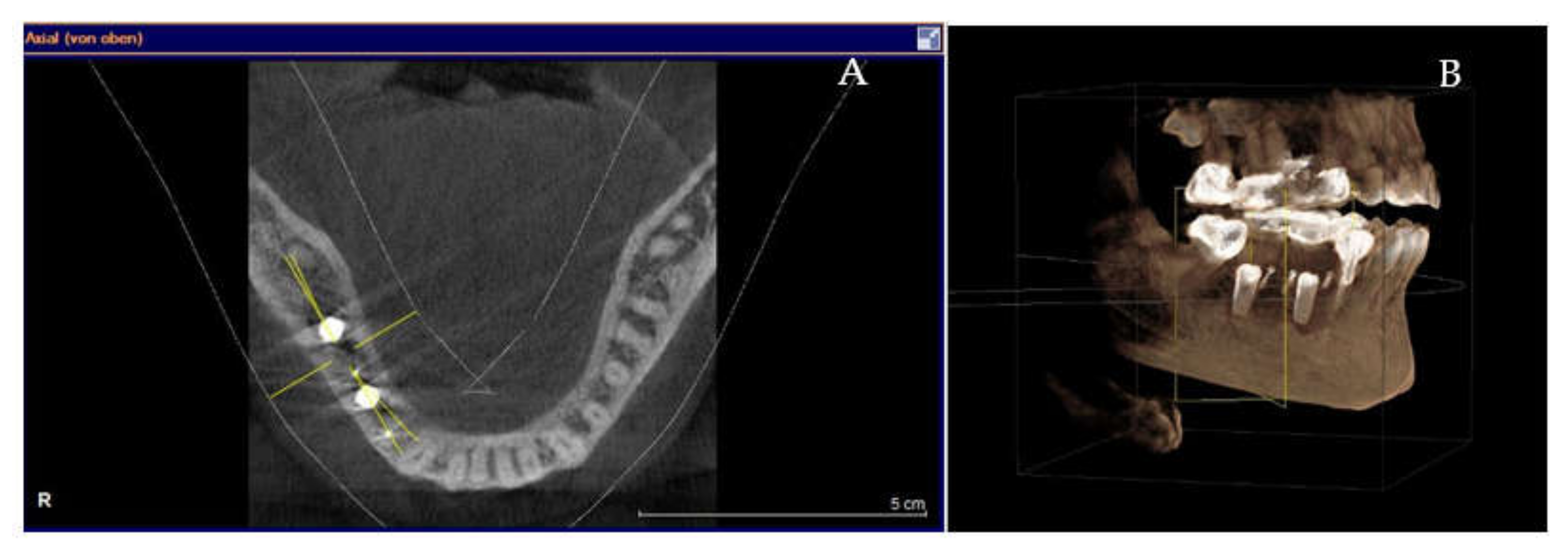 Applsci 11 06054 g007