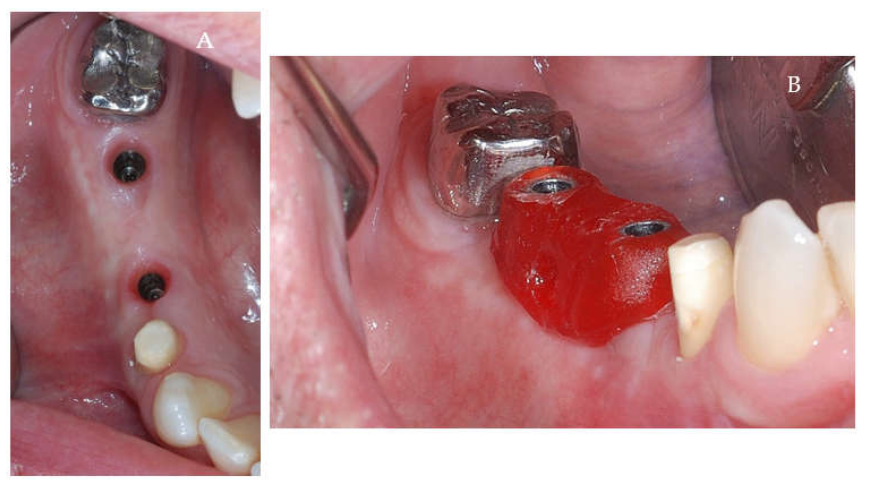 Applsci 11 06054 g009