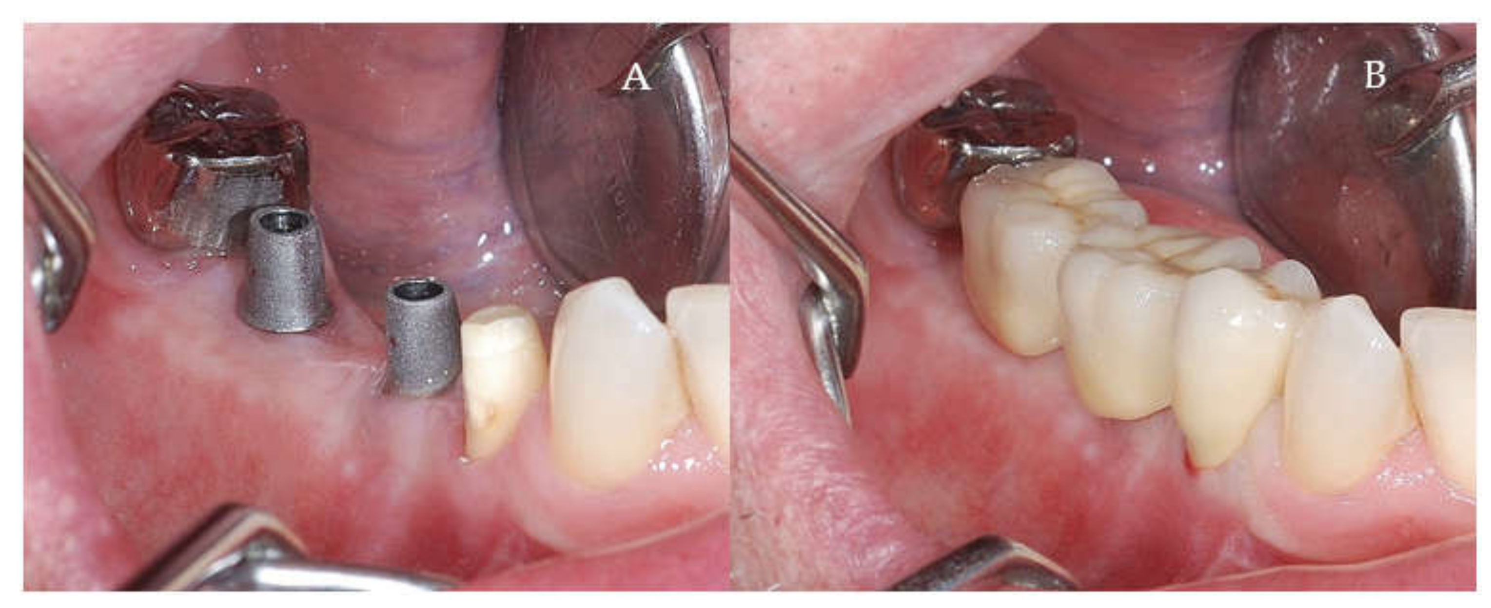 Applsci 11 06054 g010