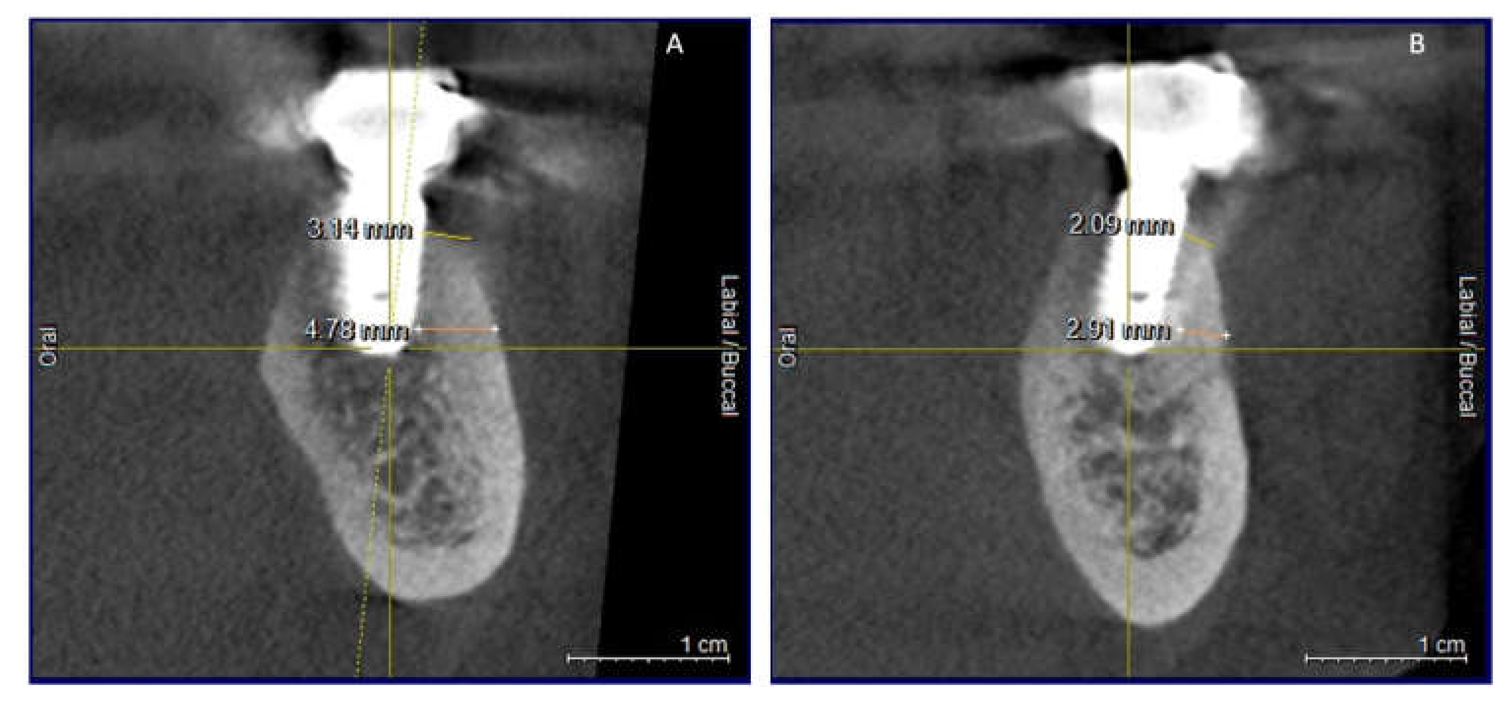 Applsci 11 06054 g011