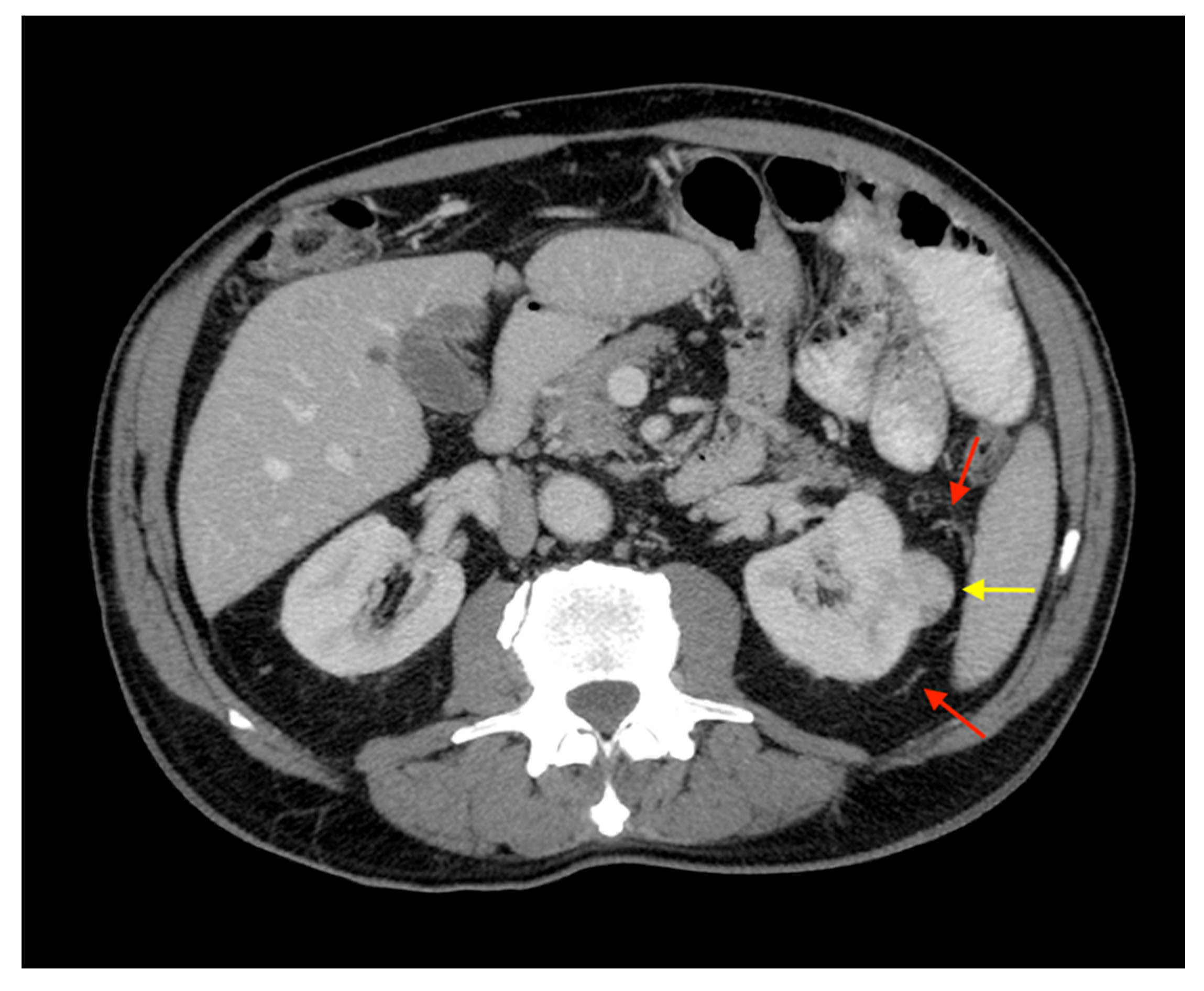 Applsci 11 06076 g001