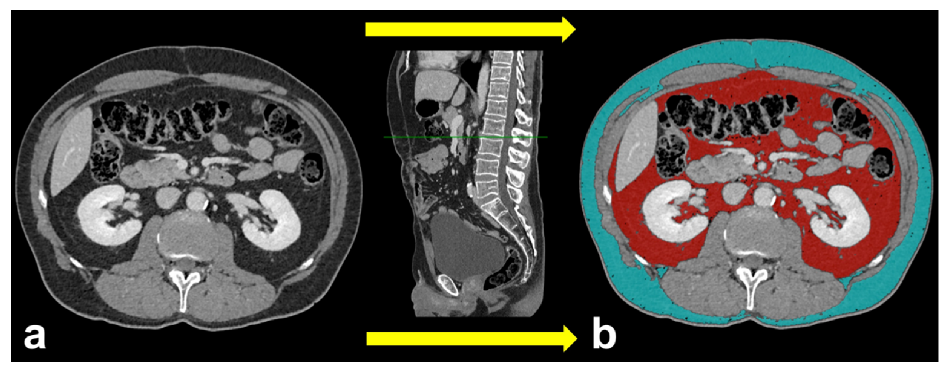 Applsci 11 06076 g002