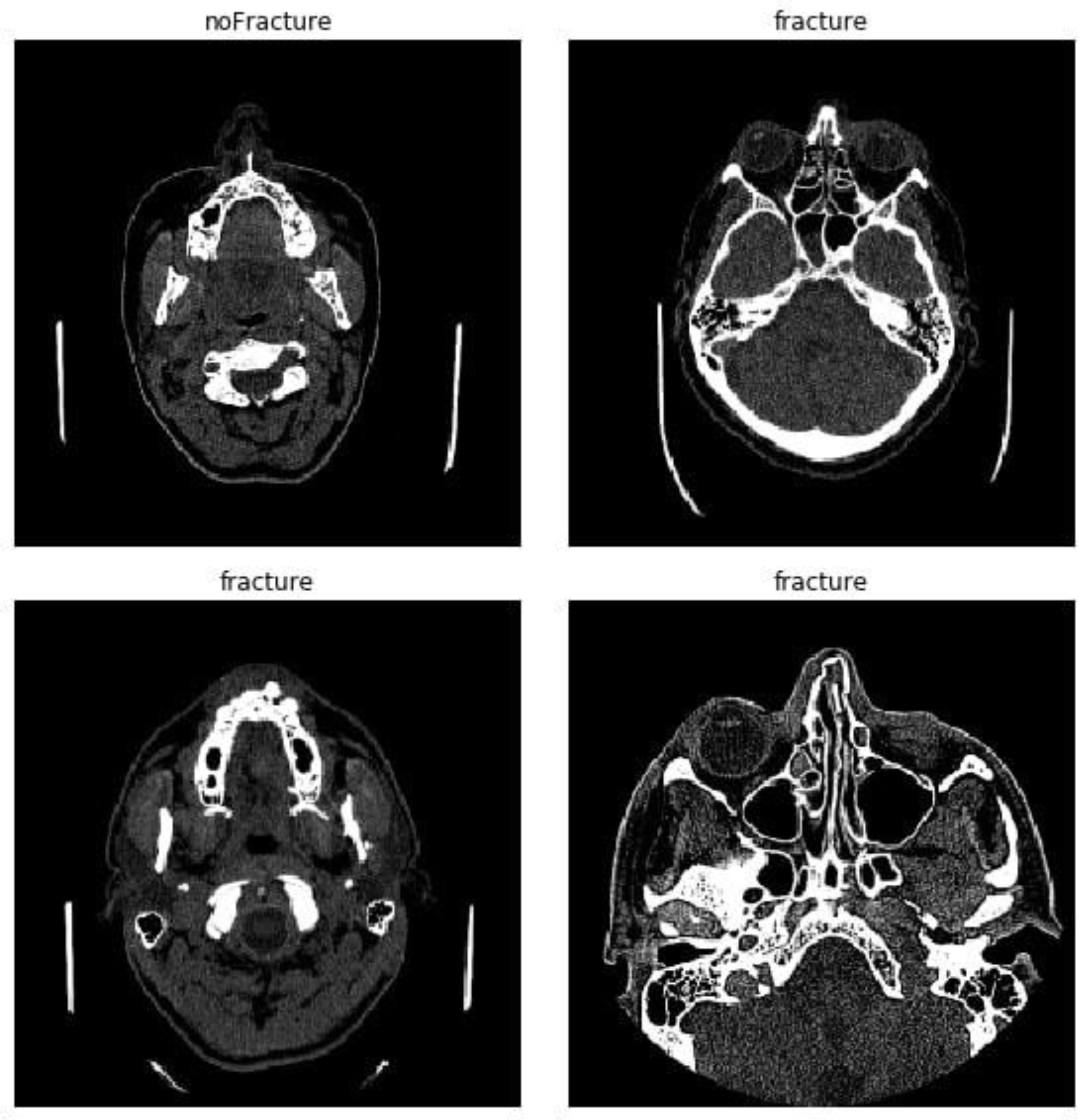 Applsci 11 06293 g004