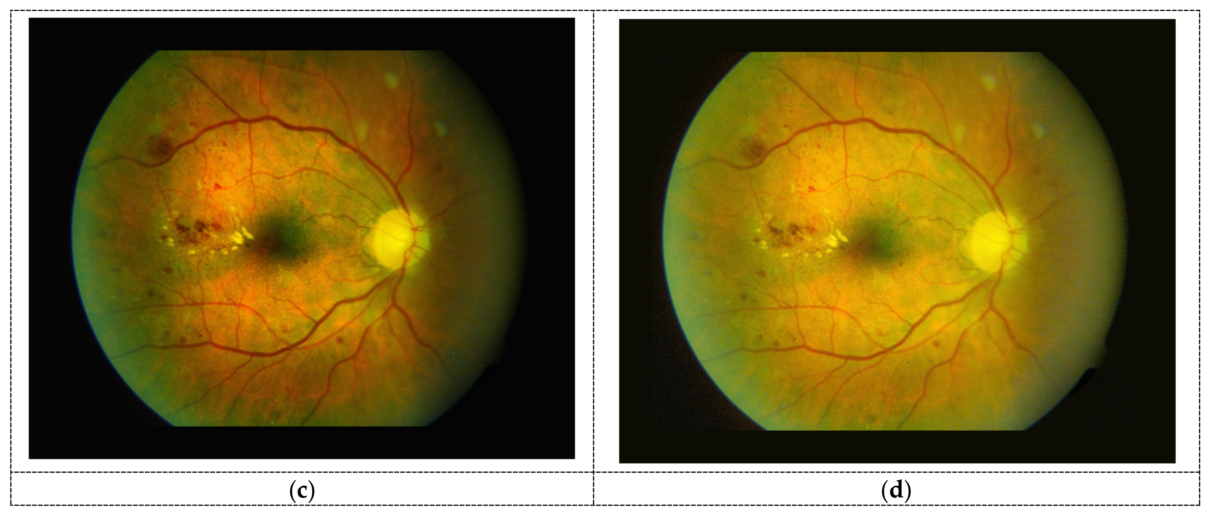 Applsci 11 06391 g003b