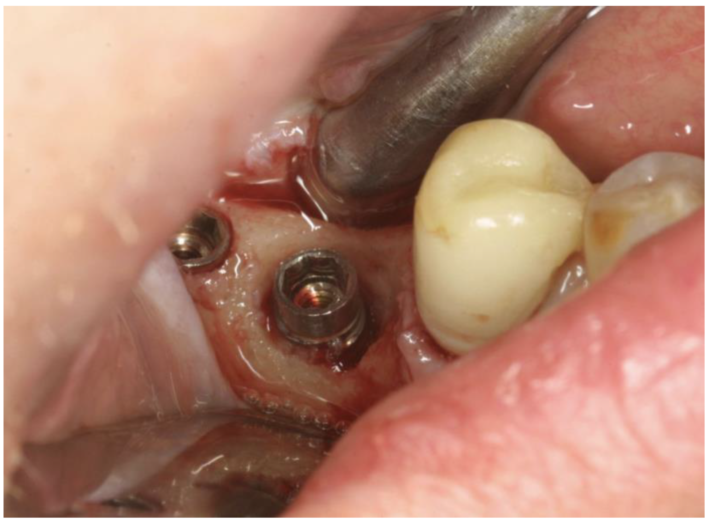 Applsci 11 06771 g002