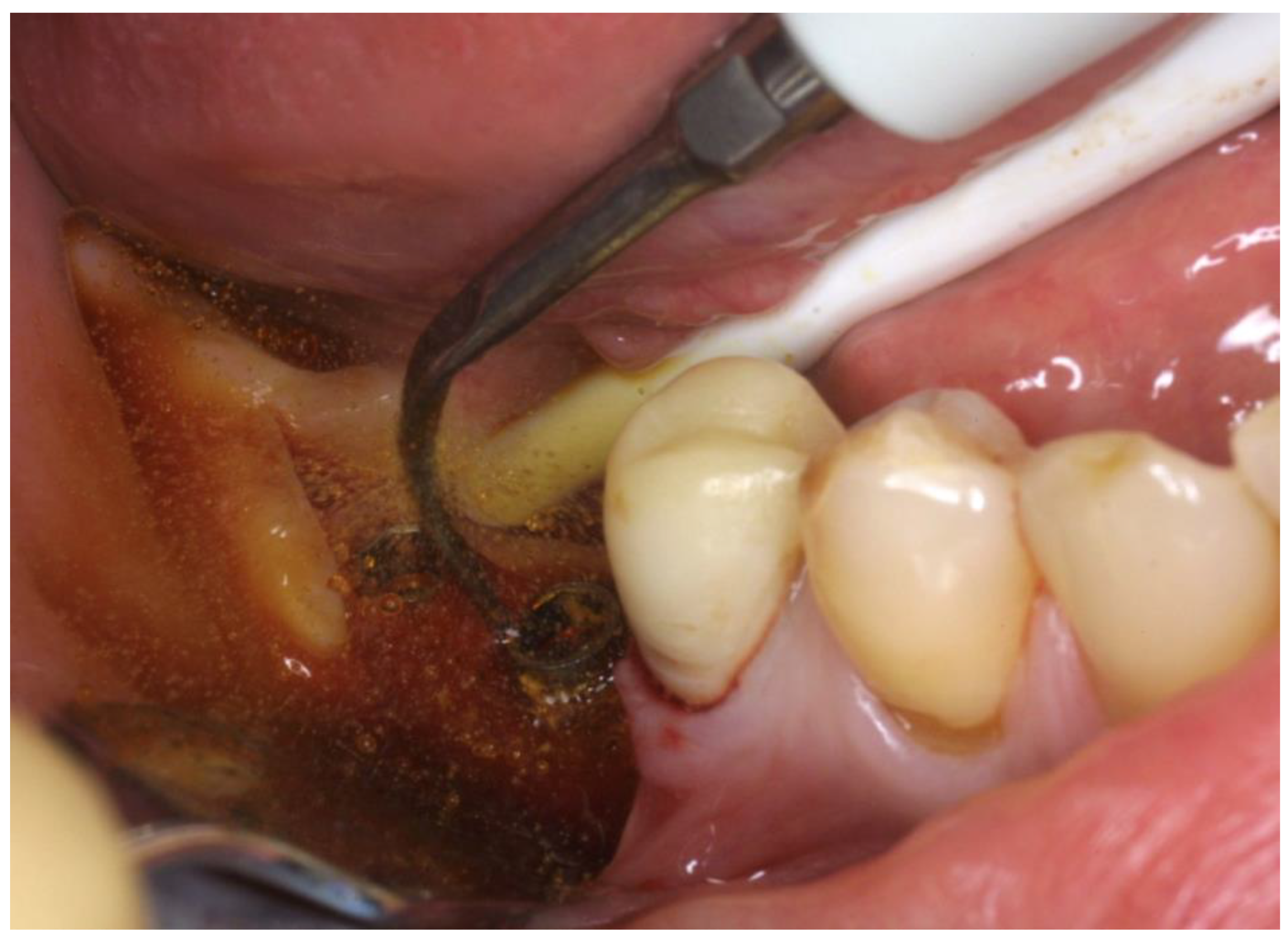 Applsci 11 06771 g003