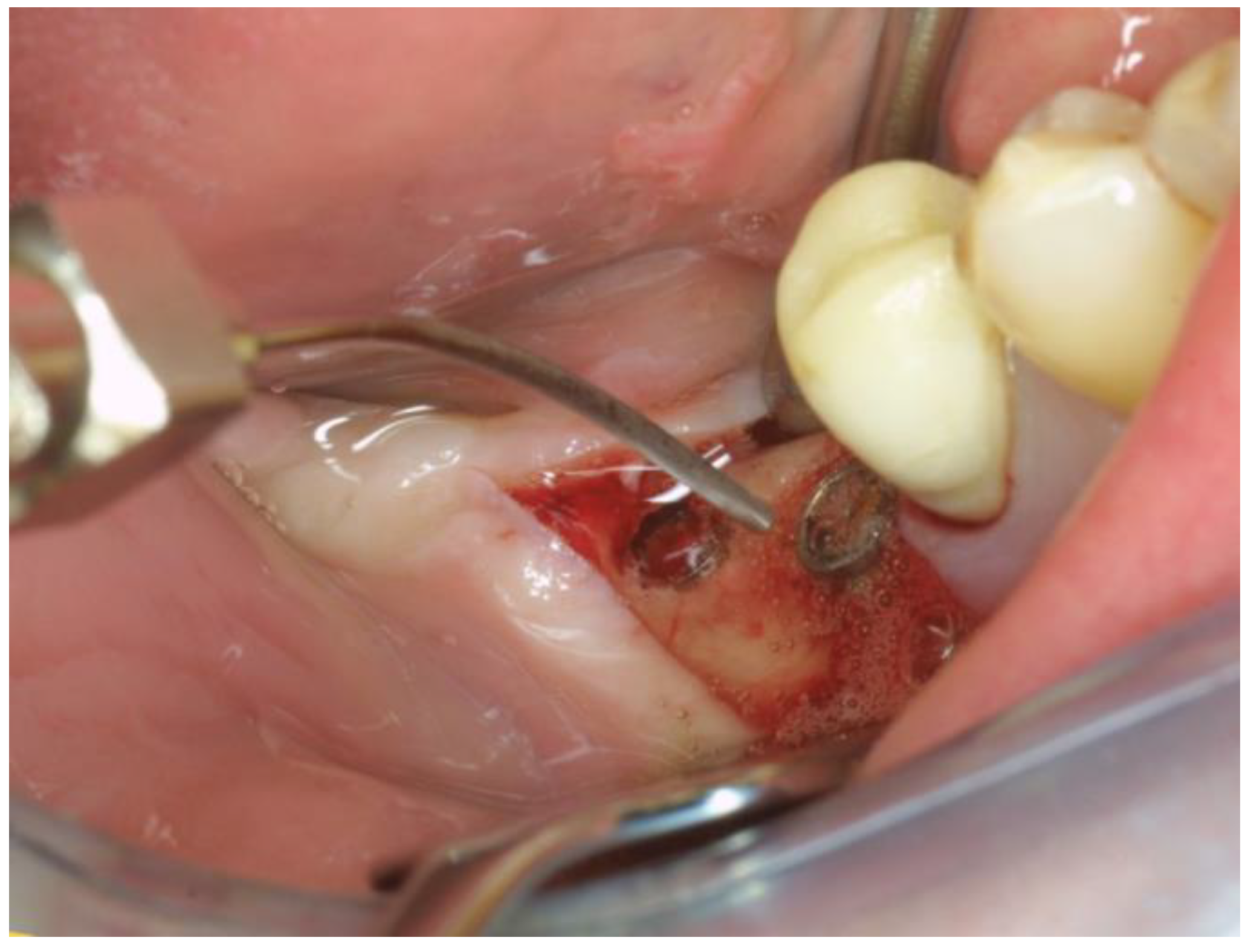 Applsci 11 06771 g004