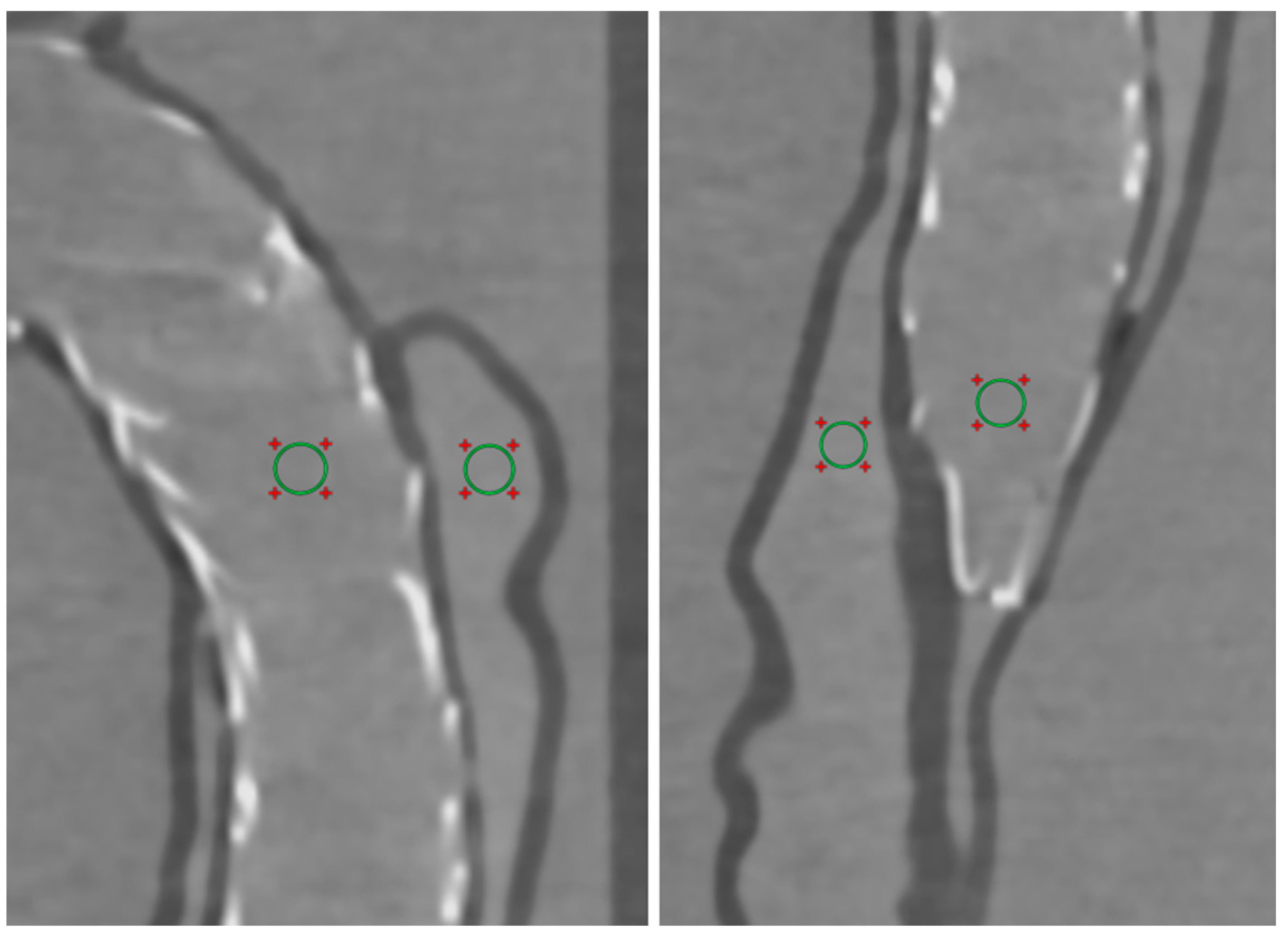 Applsci 11 06844 g004