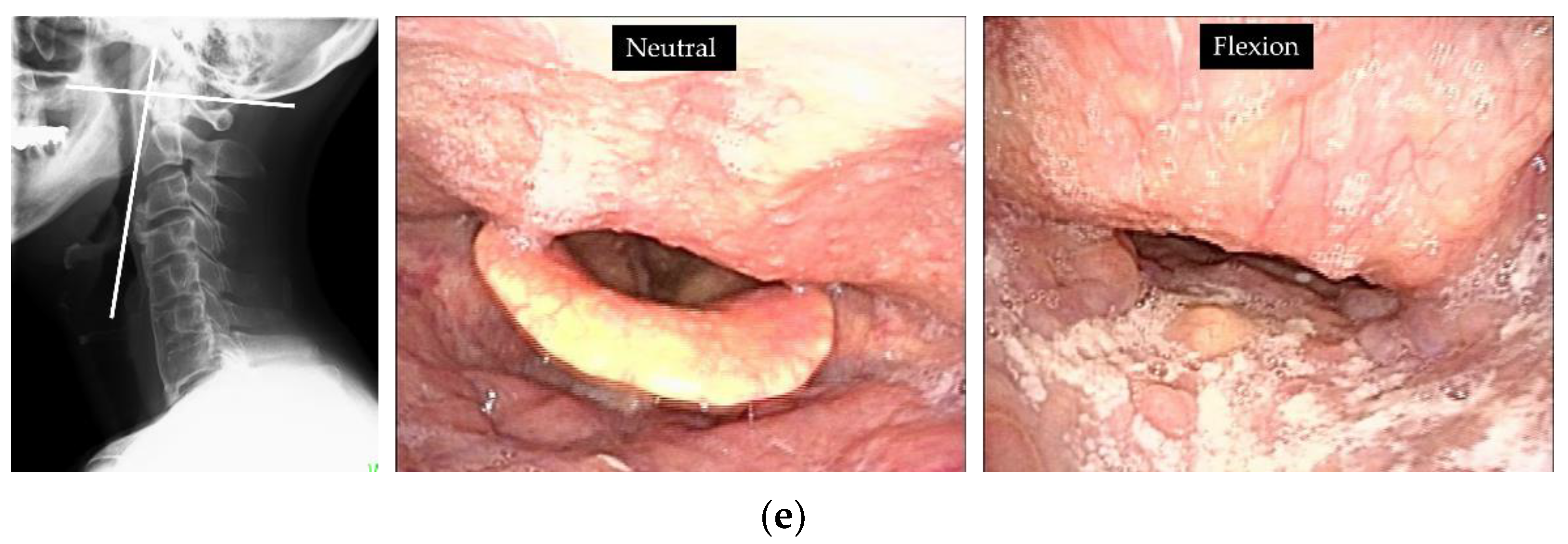 Applsci 11 07300 g004b