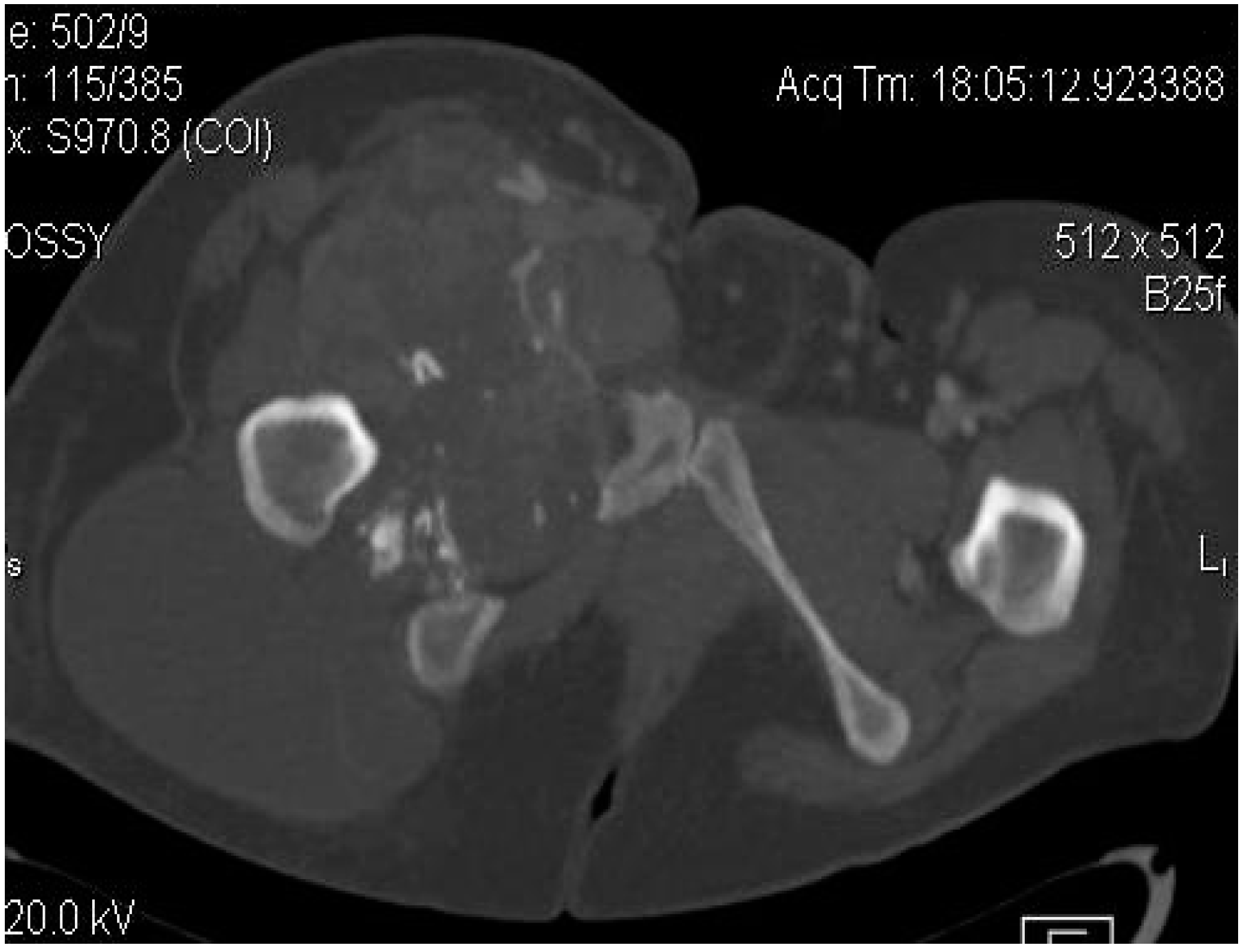 Applsci 11 07407 g006