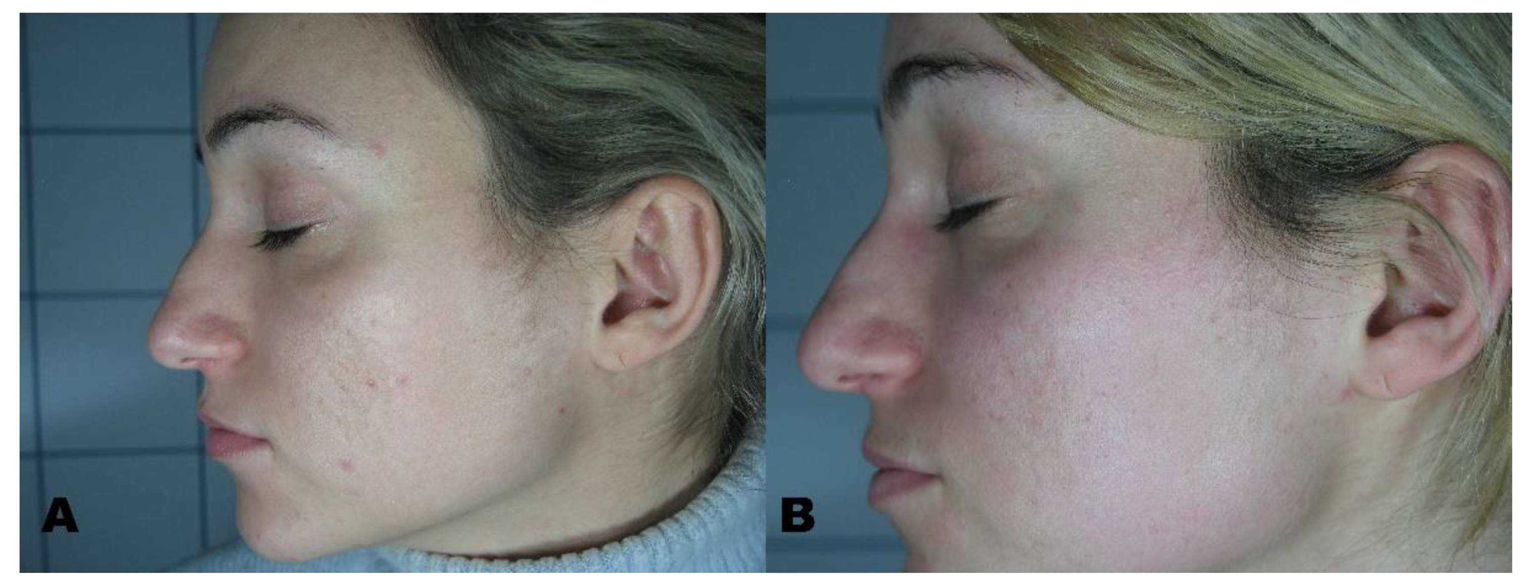 Applsci 11 07478 g005