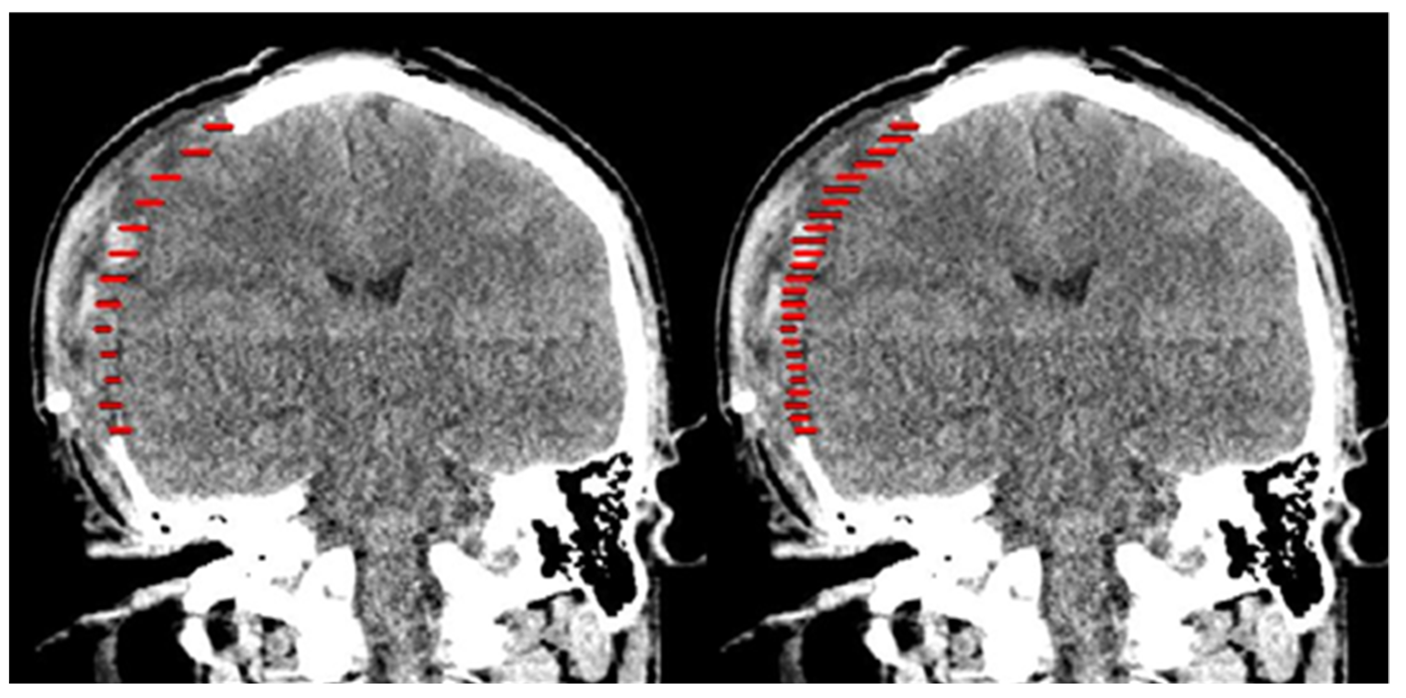 Applsci 11 07604 g007