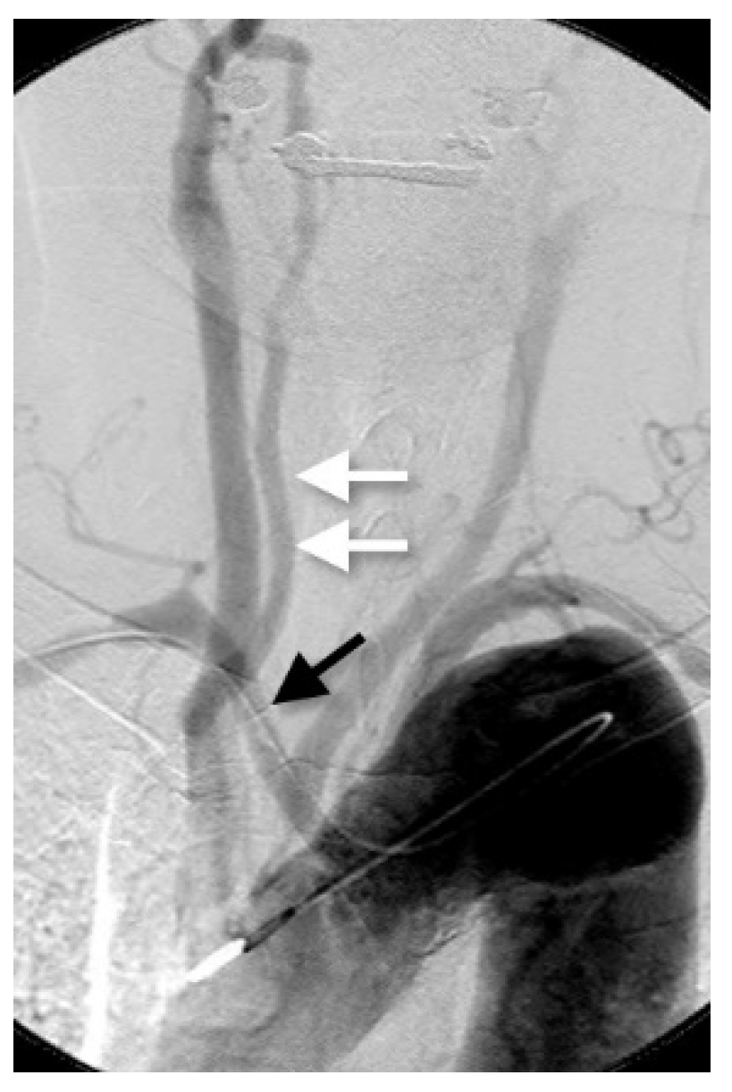 Applsci 11 08171 g005