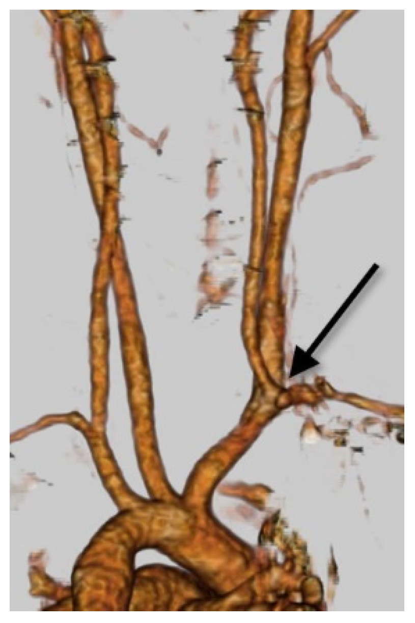 Applsci 11 08171 g006