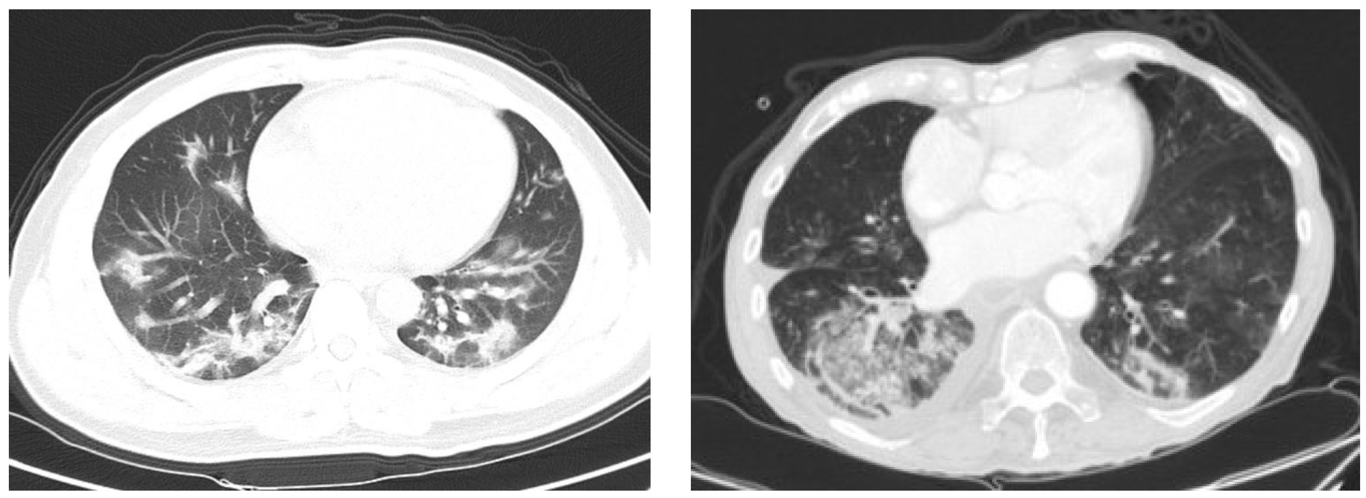 Applsci 11 08227 g003