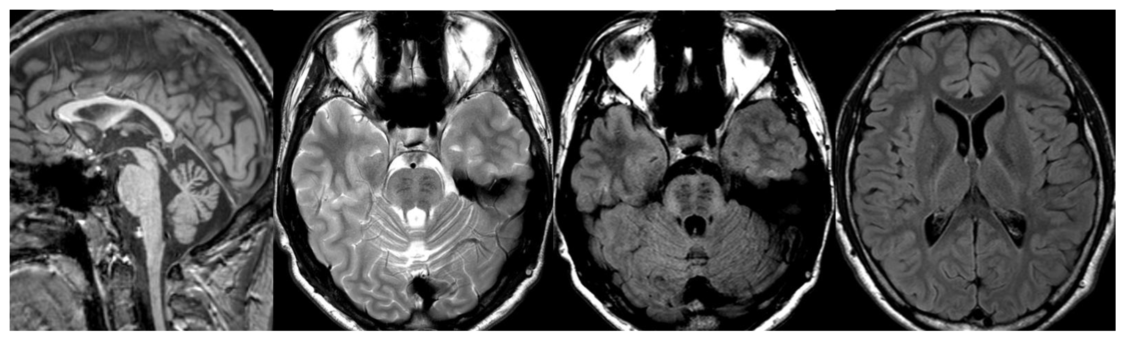 Applsci 11 08522 g004