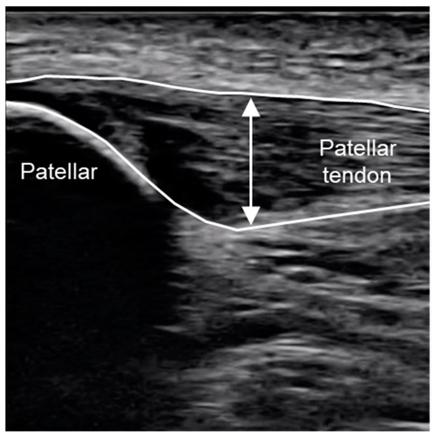 Applsci 11 08748 g001