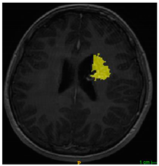 Applsci 11 09180 i001