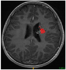 Applsci 11 09180 i002