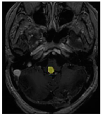 Applsci 11 09180 i007