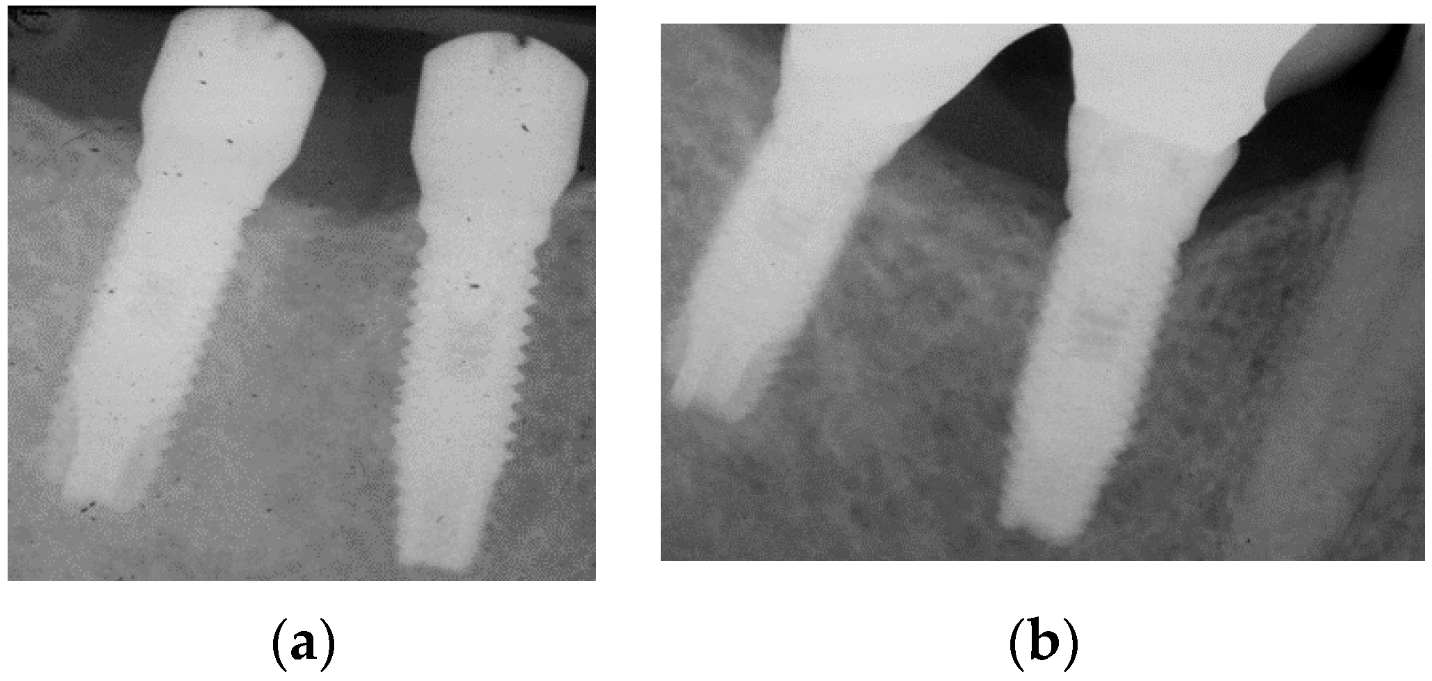 Applsci 11 09625 g002 Applsci 11 09625 g002