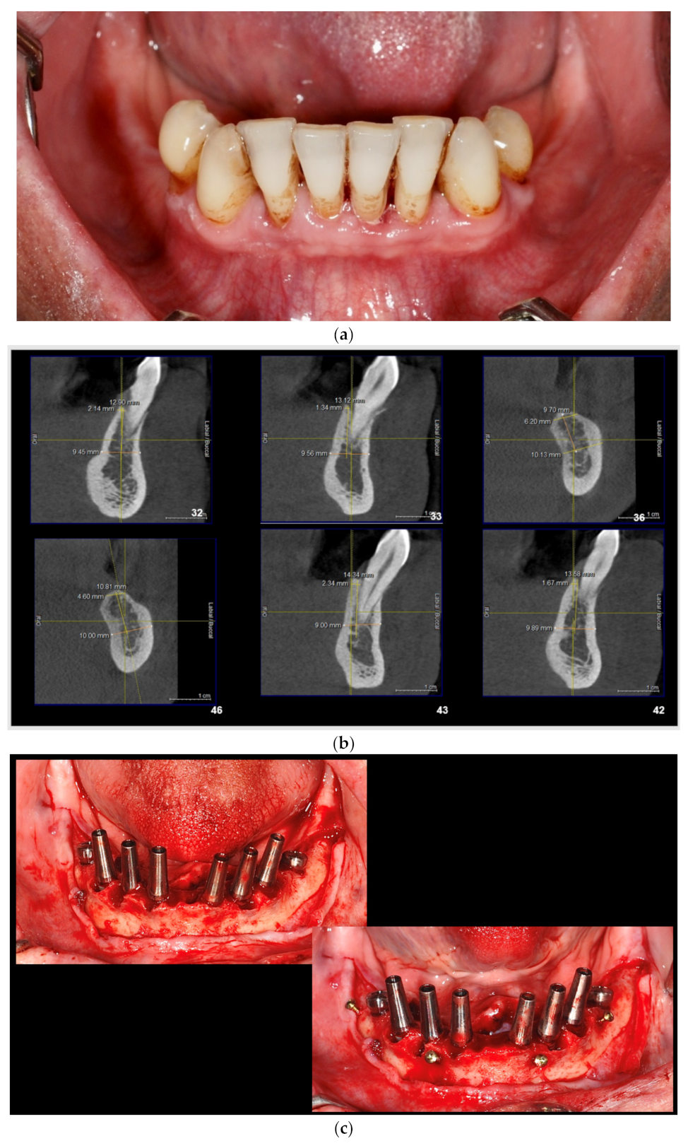 Applsci 11 09826 g001a