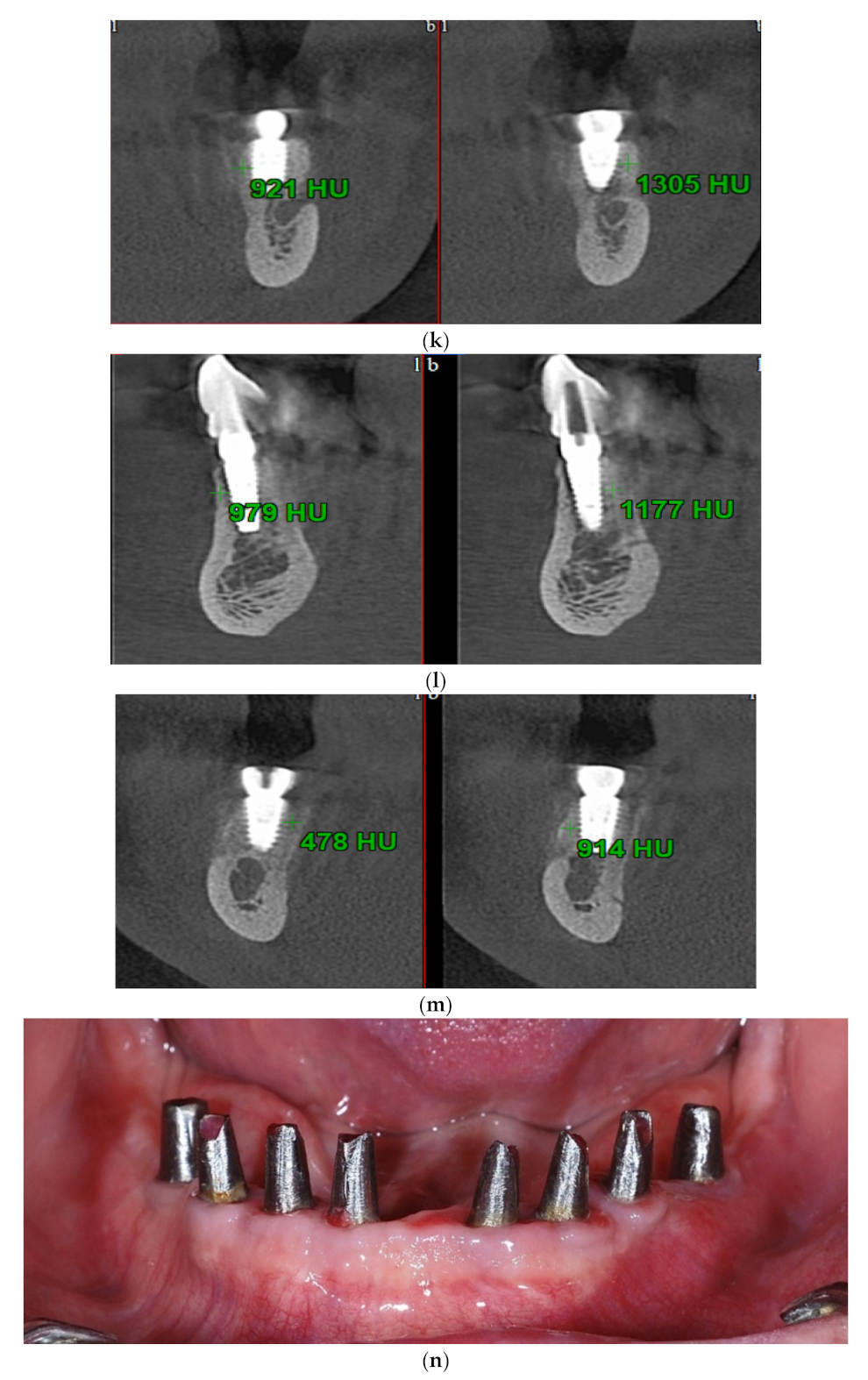 Applsci 11 09826 g001d