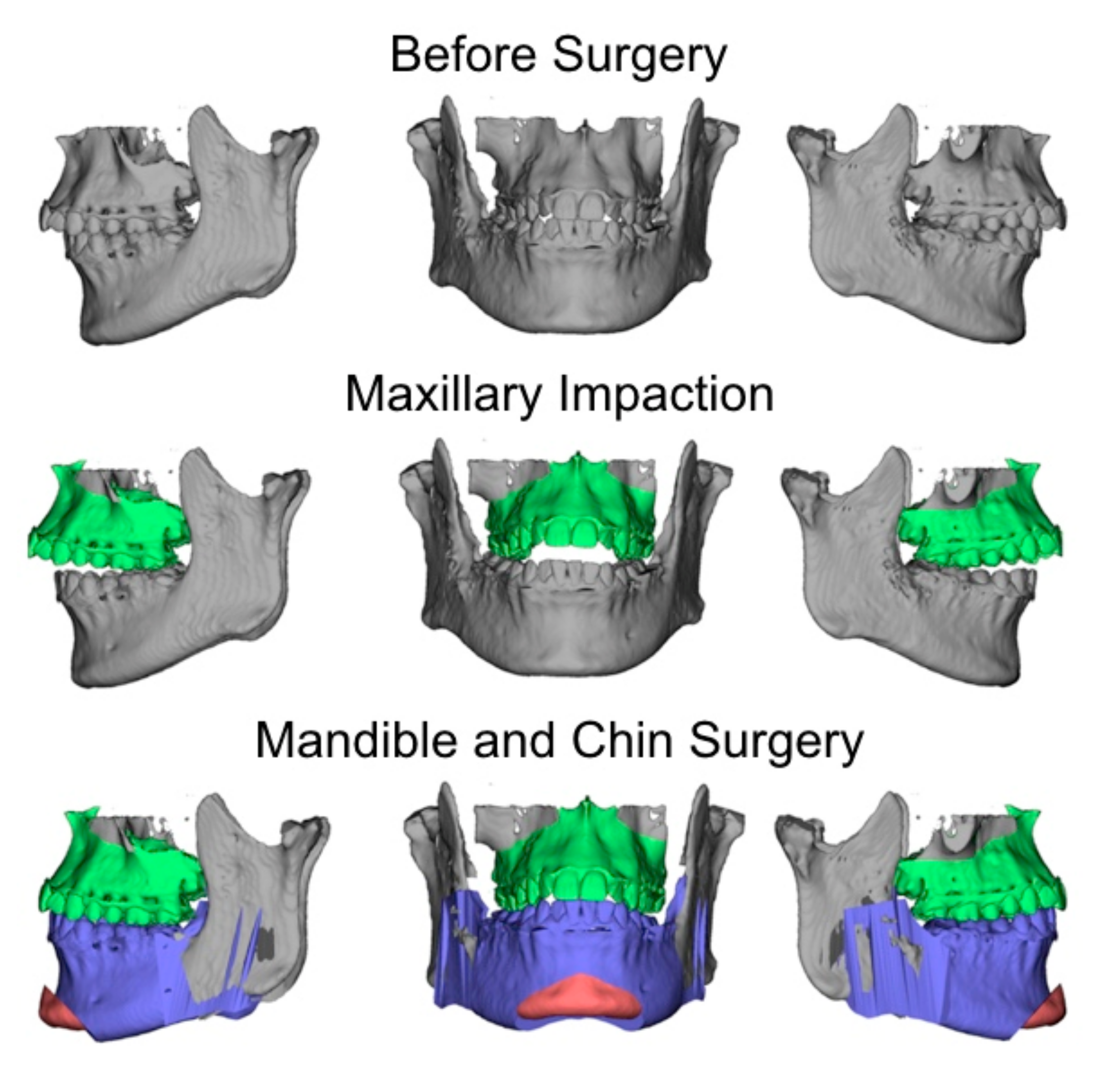 Applsci 11 09985 g003 Applsci 11 09985 g003