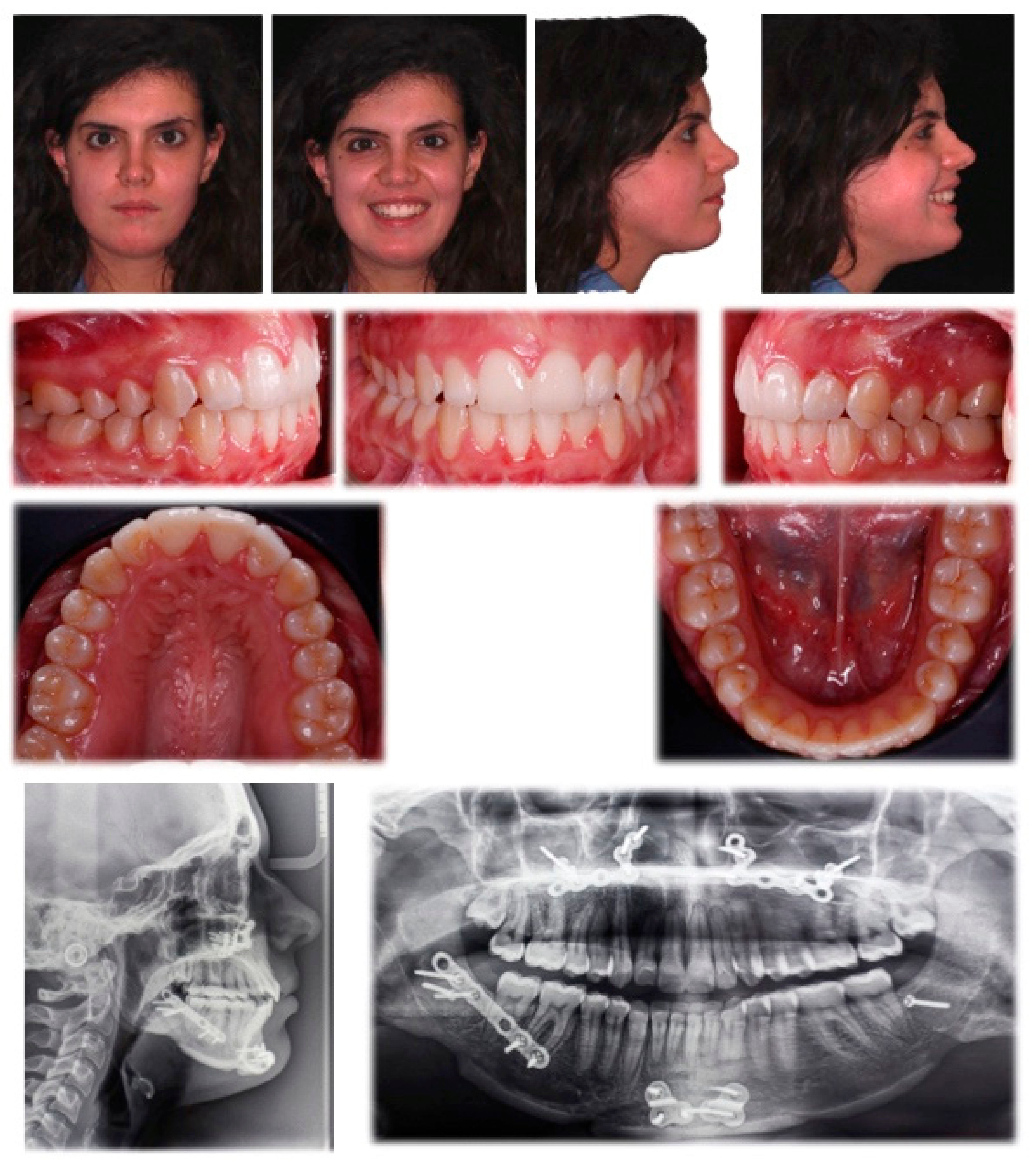 Applsci 11 09985 g006 Applsci 11 09985 g006