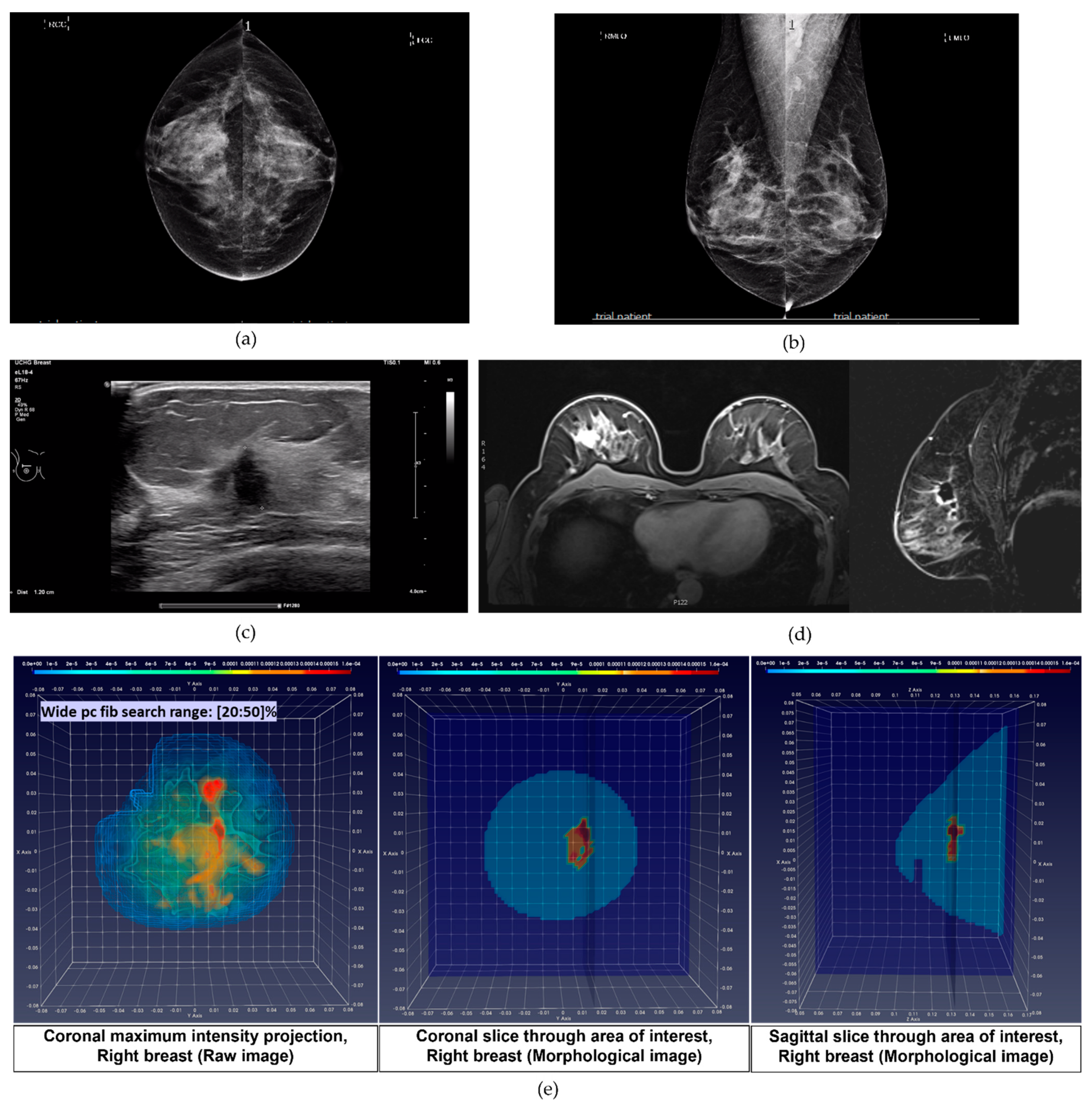 Applsci 11 09998 g005