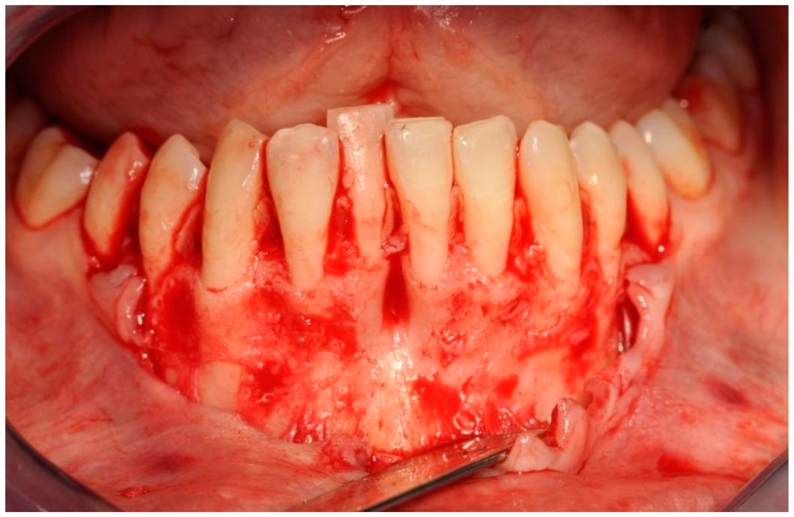 Applsci 11 10299 g005