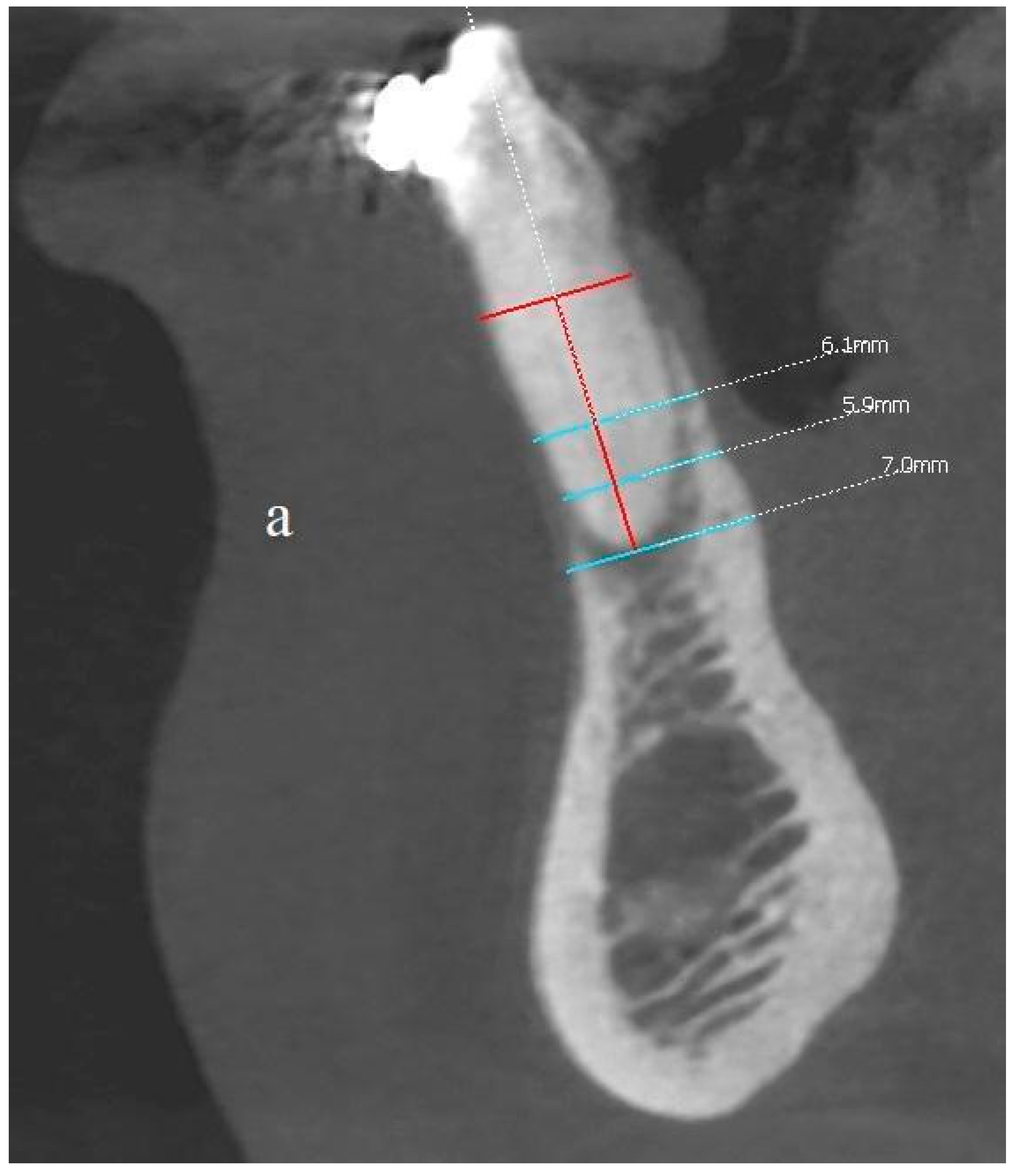 Applsci 11 10299 g013a