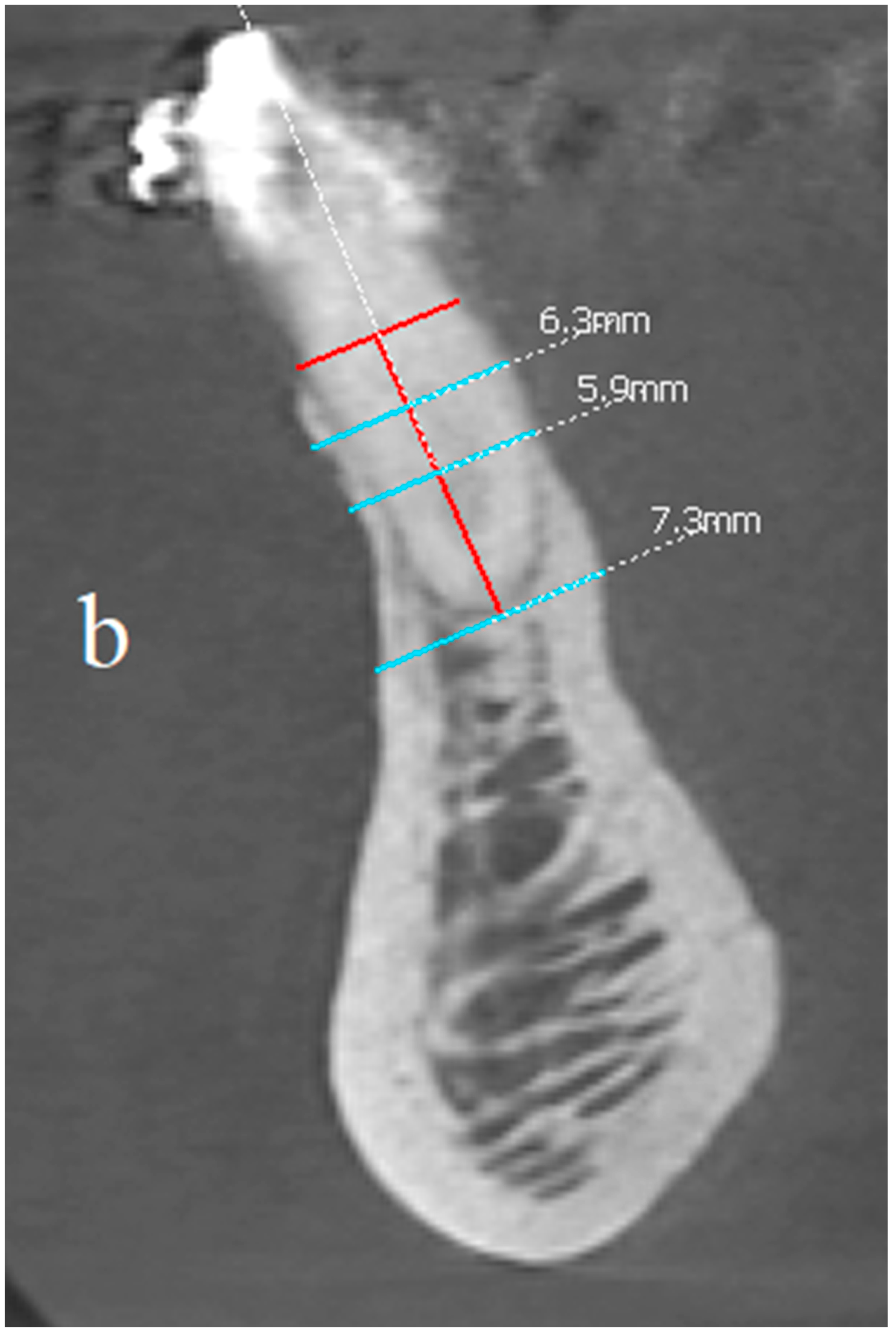Applsci 11 10299 g013b
