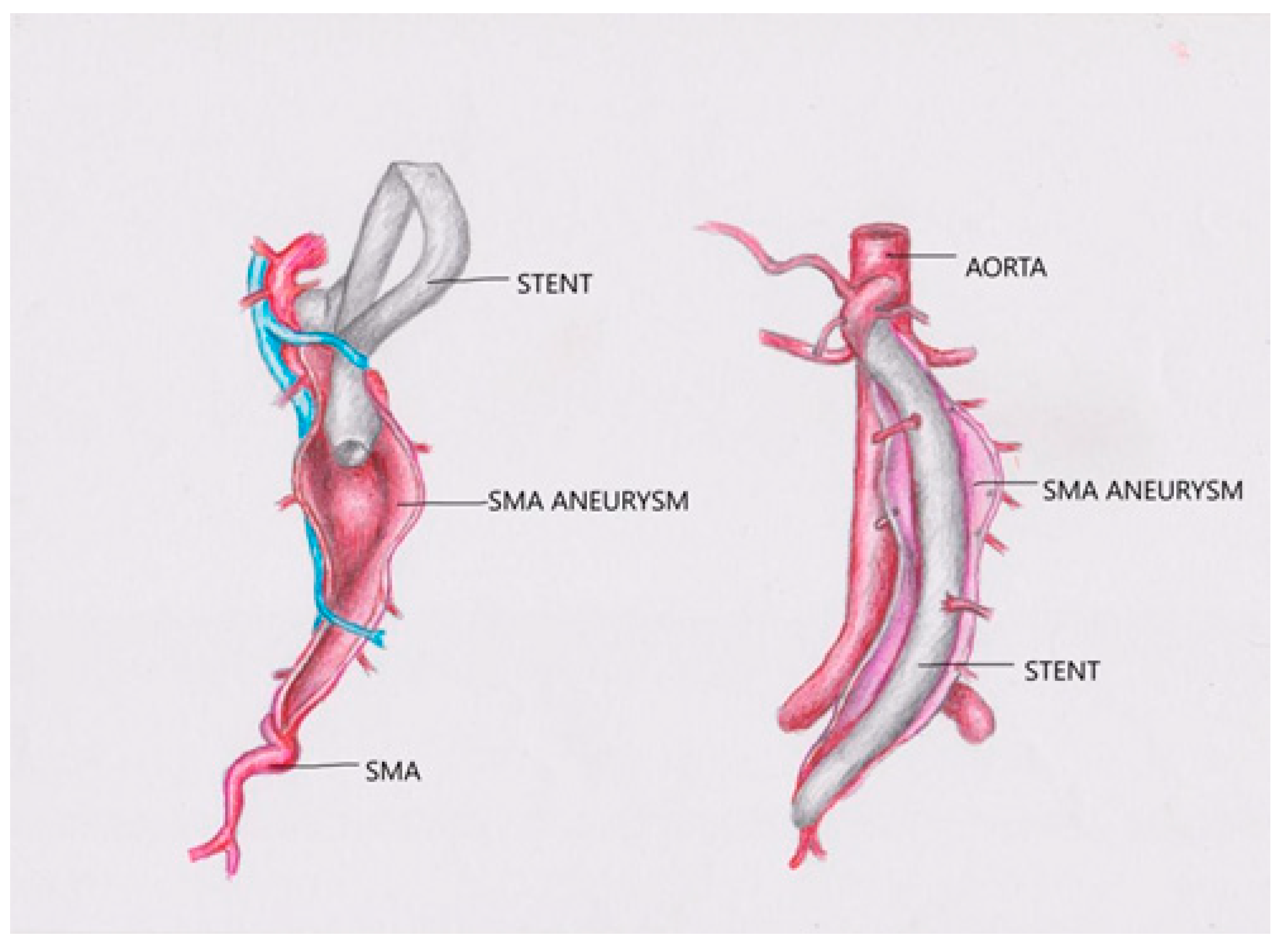 Applsci 11 10311 g010