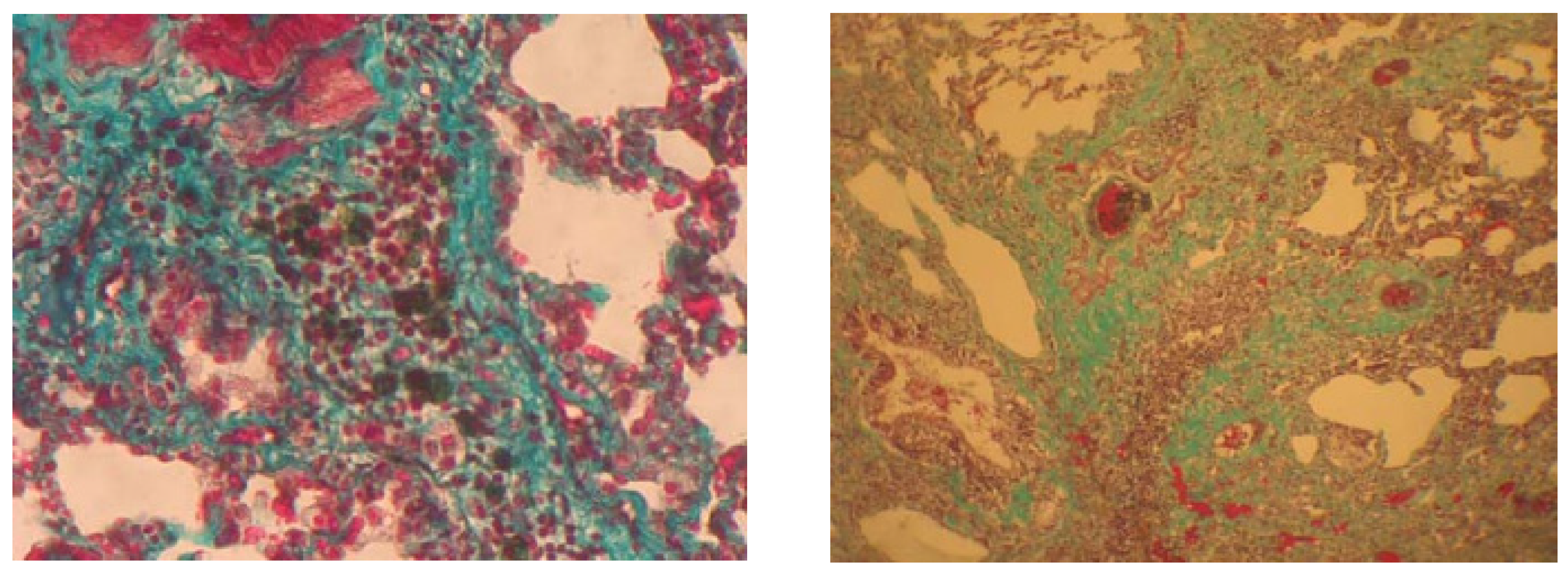 Applsci 11 10313 g003