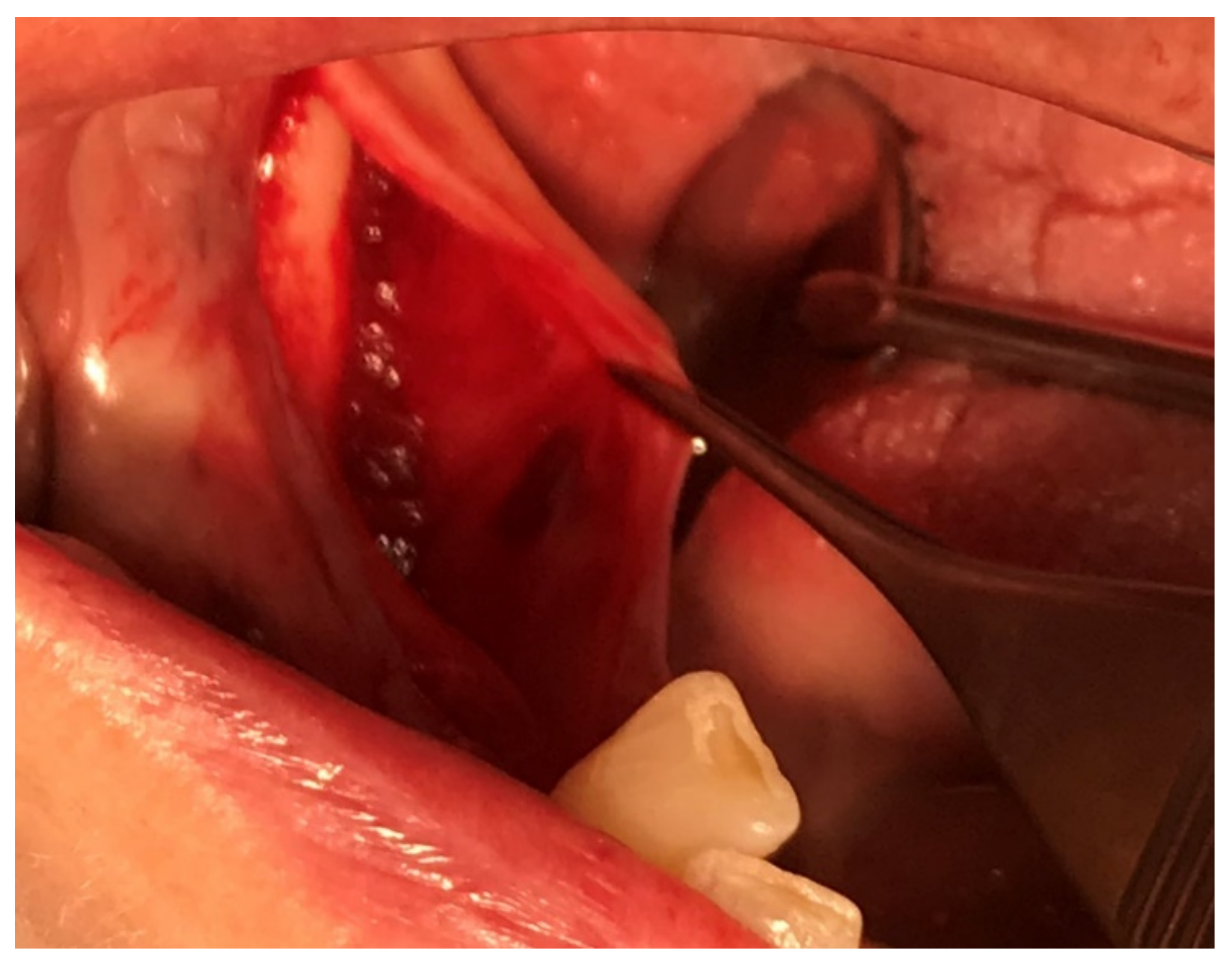 Applsci 11 10413 g005