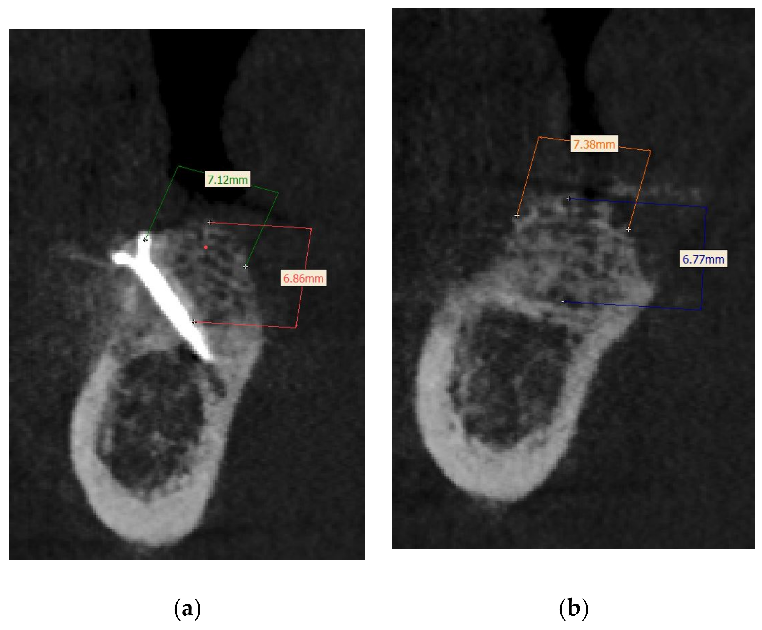 Applsci 11 10413 g012