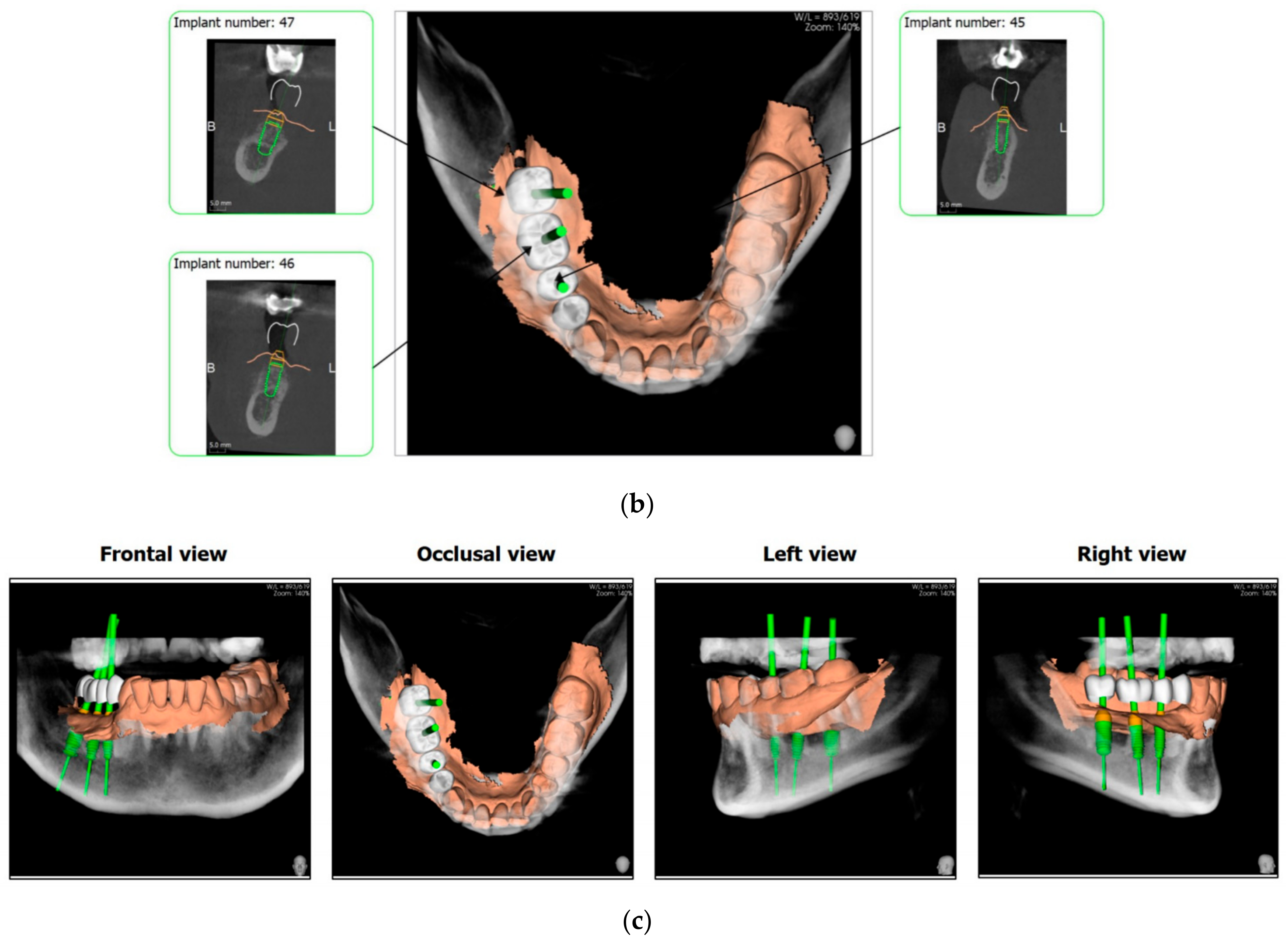 Applsci 11 10413 g013b