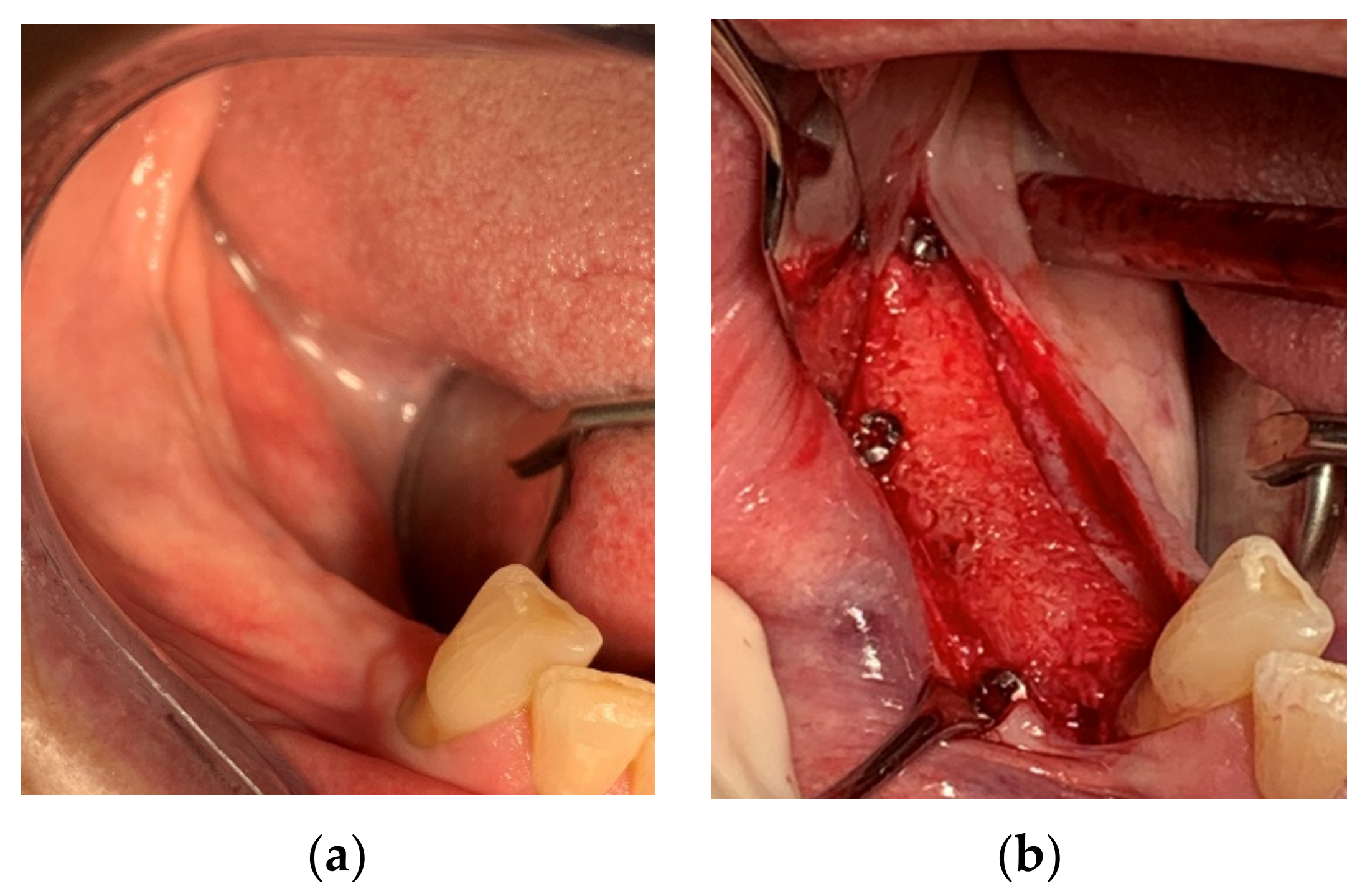 Applsci 11 10413 g014