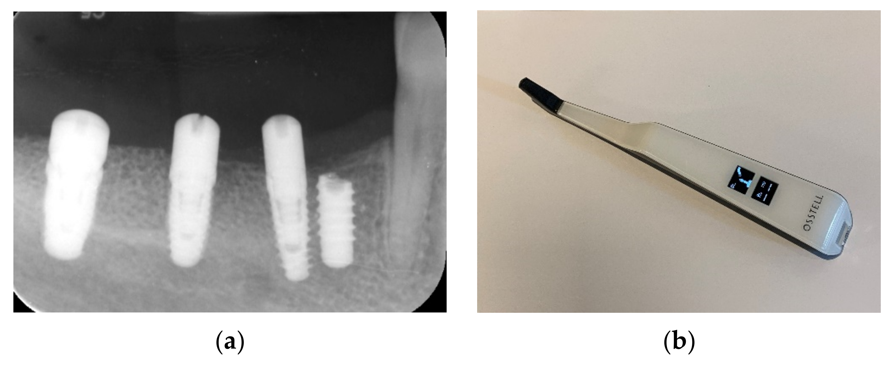 Applsci 11 10413 g018a