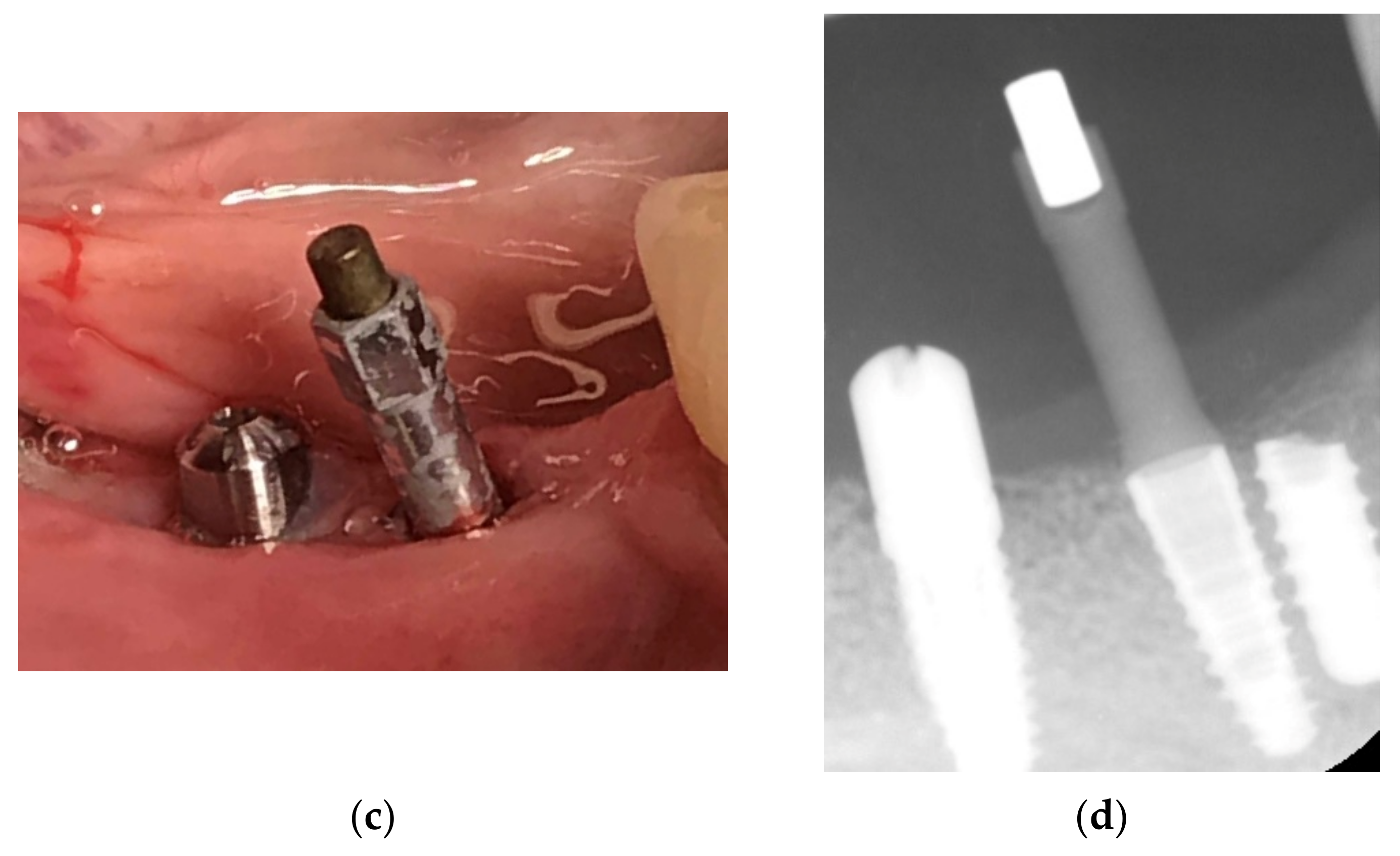 Applsci 11 10413 g018b