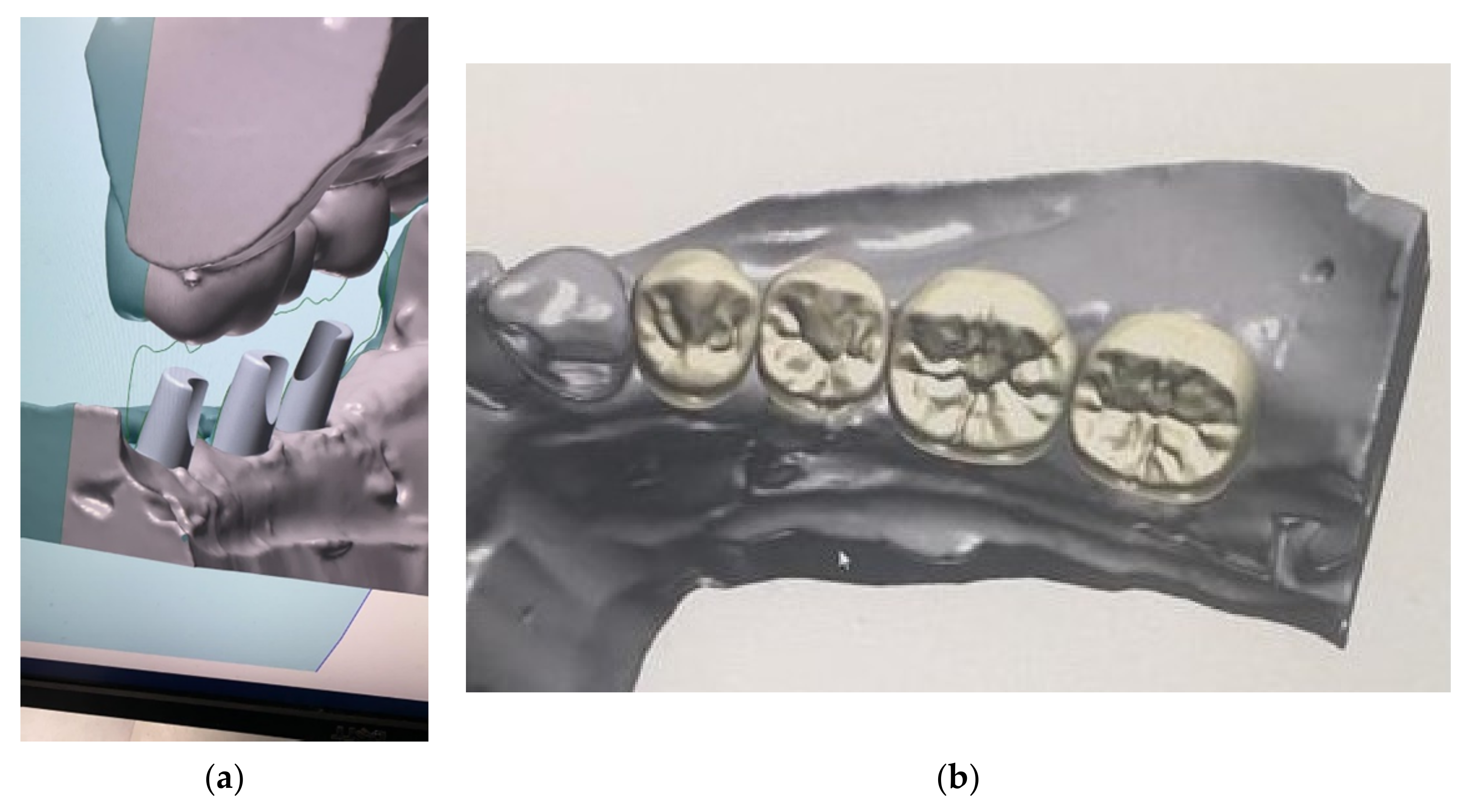 Applsci 11 10413 g019a